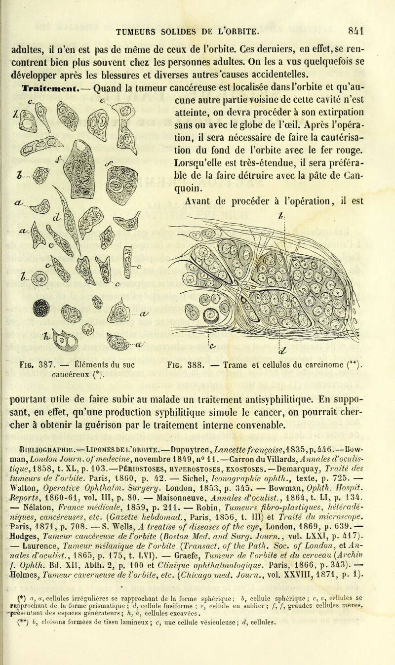 adultes, il n'en est pas de même de ceux de l'orbite. Ces derniers, en effet, se ren- contrent bien plus souvent chez les personnes adultes. On les a vus quelquefois se développer après les blessures et diverses autres causes accidentelles. Traitement.— Quand la tumeur cancéreuse est localisée dansl'orbite et qu'au- cune autre partie voisine de cette cavité n'est atteinte, on devra procéder à son extirpation sans ou avec le globe de l'œil. Après l'opéra- tion, il sera nécessaire de faire la cautérisa- tion du fond de l'orbite avec le fer rouge. Lorsqu'elle est très-étendue, il sera préféra- ble de la faire détruire avec la pâte de Can- quoin. Avant de procéder à l'opération, il est l FiG. 387. — Éléments du suc FiG. 388. — Trame et cellules du carcinome cancéreux pourtant utile de faire subir au malade un traitement antisyphilitique. En suppo- sant, en effet, qu'une production syphilitique simule le cancer, on pourrait cher- <;her à obtenir la guérison par le traitement interne convenable. Bibliographie.—Lipomesdel'orbite.—Dupuytren, Lancette française, lS3b,^.à^Q.—Bow- mm^London Journ. of médecine,novembre 1849, n° 11.—Carron du.\i\\arô.s, Annalesd'oculis- iïçwe, 1858, t. XL, p. 103.—Périostoses, hyperostoses, exostoses.—Demarquay, Traité des tumeurs de Vorbite. Paris, 1860, p. Ii2. — Sichel, Iconographie ophth., texte, p. 725. — Walton, Operative Ophtha/m. Surgenj. London, 1853, p. 345. — Bowman, Ophth. Hospit. Meports, 1860-61, vol. III, p. 80. — Maisonneuve, Annales d'oculist., 186/i, t. LI, p. 134. — Nélaton, France médicale., 1859, p. 211. — Robin, Tumeurs fibro-plastiques, hétèradé- niques, cancéreusesetc. {Gazette hehdomad., Paris, 1856, t. III) et Traité du microscope. Paris, 1871, p. 708. — S. Wells, A treatise of diseases of the eije, London, 1869, p. 639.— Hodges, Tumeur cancéreme del'orbite {Boston Med. and Surg. Journ., vol. LXXT, p. Û17). — Laurence, Tumeur mélanique de l'orbite {Transact. of the Path. Soc. of London, et An- nales d'oculist., 1865, p. 175, t. LVI). — Graefe, Tumeur de l'orbite et du cerveau {Archiv f. Ophth. Bd. XII, Abth. 2, p. 100 et Clinique ophthalmologique. Paris, 1866, p. 343). — •Holmes, Tumeur caverneuse de l'orbite, etc. {Chicago med. Journ., vol. XXVIII, 1871, p. 1). (*) a, («, cellules iiTégiilières se rapprocliant de la forme spliérlque ; h, cellule sphérique ; c, c, cellules se rapprochant de la forme prismatique ; cl, cellule fusiforme ; c, cellule en sablier ; f, f, grandes cellules mères, préstntant des espaces générateurs; h, h, cellules excavées. (**J cloisons formées de tissu laraineux ; c, une cellule vésiculeuse ; d, cellules.