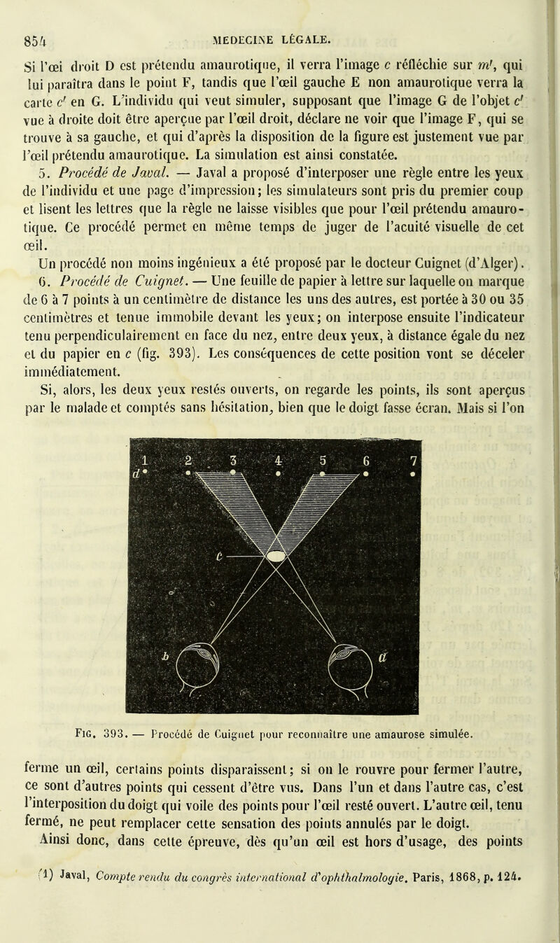 Si Toei droit D est prétendu amaurotique, il verra l'image c réfléchie sur m', qui lui paraîtra dans le point F, tandis que l'œil gauche E non amaurolique verra la carte en G. L'individu qui veut simuler, supposant que l'image G de l'objet c' vue à droite doit être aperçue par l'œil droit, déclare ne voir que l'image F, qui se trouve à sa gauche, et qui d'après la disposition de la figure est justement vue par Tœil prétendu amaurotique. La simulation est ainsi constatée. 5. Procédé de Javal. — Javal a proposé d'interposer une règle entre les yeux de l'individu et une page d'impression; les simulateurs sont pris du premier coup et lisent les lettres que la règle ne laisse visibles que pour l'œil prétendu amauro- tique. Ce procédé permet en même temps de juger de l'acuité visuelle de cet œil. Un procédé non moins ingénieux a été proposé par le docteur Cuignet (d'Alger). (3. Procédé de Cuignet. — Une feuille de papier à lettre sur laquelle on marque de 6 à 7 points à un centimètre de distance les uns des autres, est portée à 30 ou 35 centimètres et tenue immobile devant les yeux; on interpose ensuite l'indicateur tenu perpendiculairement en face du nez, entre deux yeux, à distance égale du nez et du papier en c (fig. 393). Les conséquences de cette position vont se déceler immédiatement. Si, alors, les deux yeux restés ouverts, on regarde les points, ils sont aperçus par le malade et comptés sans hésitation^ bien que le doigt fasse écran. Mais si l'on FiG, 393. — Procédé de Cuignet pour reconnaître une amaurose simulée. ferme un œil, certains points disparaissent; si on le rouvre pour fermer l'autre, ce sont d'autres points qui cessent d'être vus. Dans l'un et dans l'autre cas, c'est l'interposition du doigt qui voile des points pour l'œil resté ouvert. L'autre œil, tenu fermé, ne peut remplacer cette sensation des points annulés par le doigt. Ainsi donc, dans cette épreuve, dès qu'un œil est hors d'usage, des points fl) Javal, Compte rendu du congrès international d'ophthalmologie. Paris, 1868, p. 124.