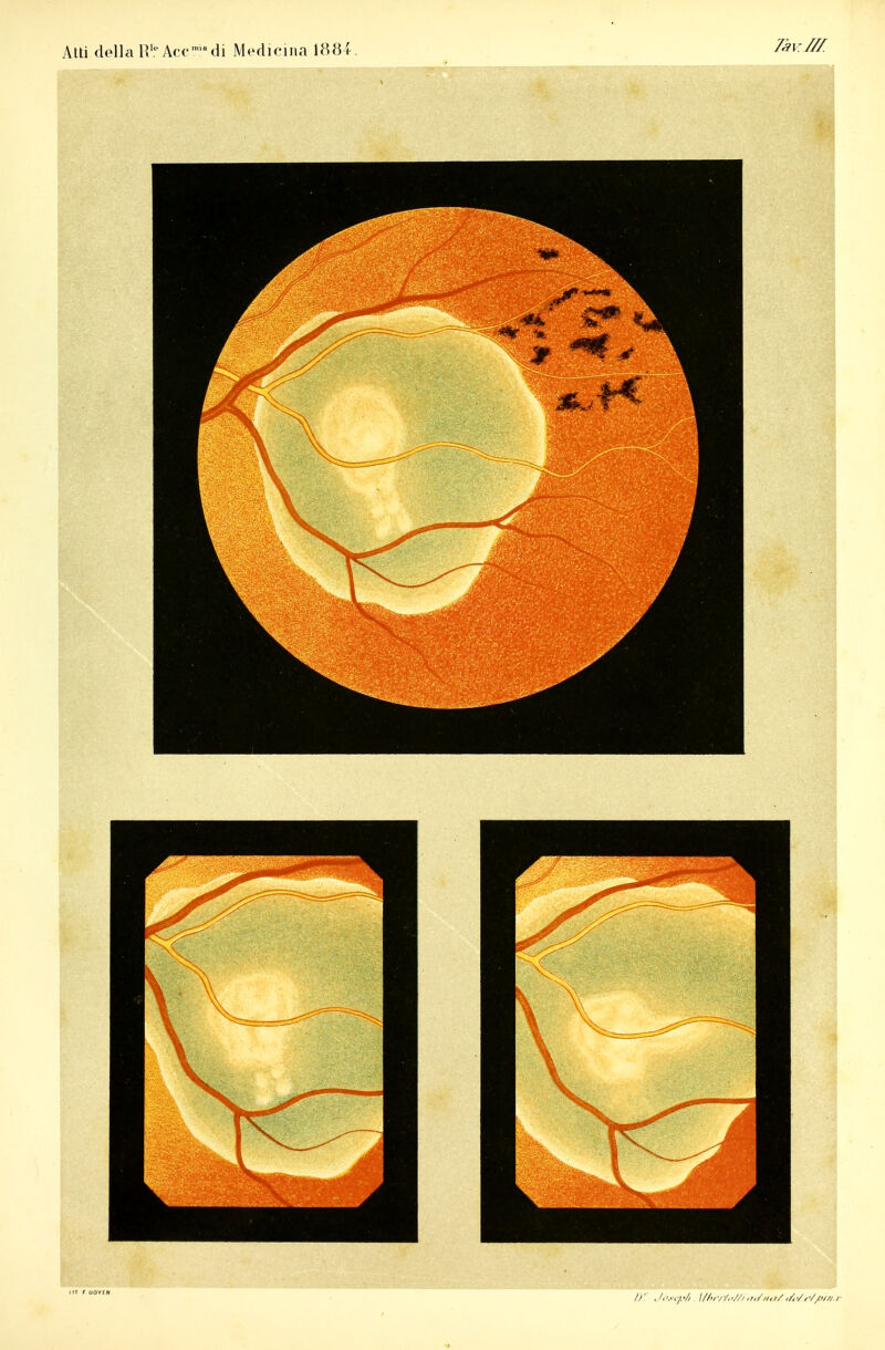 Atti dellaR1*Accadi Medicina 1884