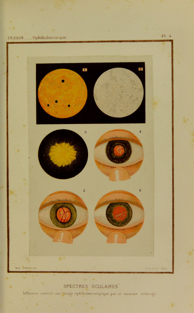 PÊ RHIN Ophthàlmosoopie Pl. 4» Imp I.emepciop SPECTRES OCULAIRES influence exercée suc l'image ophlhalirtosoopUjii.é par un mauvais éclairage