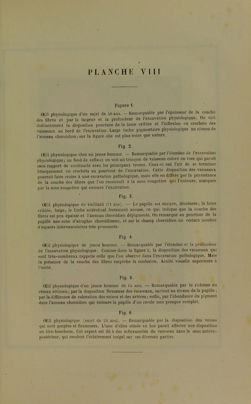 > PLANCHE VIII Figure 1. OEil physiologique d'un sujet de 50 ans. - Remarquable par l'épaisseur de la couche des fibres et par la largeur et la profondeur de l'excavation physiologique. On voit distinctement la disposition ponctuée de la lame criblée et l'inflexion en crochets des vaisseaux au bord de l'excavation. Large tache pigmentaire physiologique au niveau de l'anneau choroïdien ; sur la figure elle est plus noire que nature. Fig. 2. OEil physiologique chez un jeune homme. — Remarquable par l'étendue de l'excavation physiologique; au fond de celle-ci on voit un tronçon de vaisseau coloré en rose qui paraît sans rapport de continuité avec les principaux troncs. Ceux-ci ont l'air de se terminer brusquement en crochets au pourtour de l'excavation. Cette disposition des vaisseaux pourrait faire croire à une excavation pathologique, mais elle en diffère par la persistance de la couche des fibres que l'on reconnaît à la zone rougeâtre qui l'entoure, marquée par la zone rougeâtre qui entoure l'excavation. Fig. 3. OEil physiologique de vieillard (7t ans). — La papille est maigre, décolorée; la lame criblée, large; le limbe sclérotical fortement accusé, ce qui indique que la couche des fibres est peu épaisse et l'anneau choroïdien dépigmenté. On remarque au pourtour de la papille une zone d'atrophie choroïdienne, et sur le champ choroïdien un certain nombre d'espaces intervasculaires très-prononcés. Fig 4 OEil physiologique de jeune homme. — Remarquable par l'étendue et la profondeur de l'excavation physiologique. Comme dans la figure 2, la disposition des vaisseaux qui sont très-nombreux rappelle celle que l'on obsenc dans l'excavation pathologique. Mais la présence de la couche des fibres empêche la confusion. Acuité visuelle supérieure à l'unité. Fig. 5. OEil physiologique d'un jeune homme de 15 ans. — Remarquable par la richesse du réseau rétinien; par la disposition flexueuse des vaisseaux, surtout au niveau de la papille ; parla différence de coloration des veines et des artères; enfin, par l'abondance du pigment dans l'anneau choroïdien qui entoure la papille d'un cercle noir presque complet. Fig. 6. OEil physiologique (sujet de 25 ans). — Remarquable par la disposition des veines qui sont gorgées et tlexueuses. L'une d'elles située en bas paraît affecter une disposition en tire-bouchons. Cet aspect est dû à des inflexuosités du vaisseau dans le sens antéro- postérieur, qui rendent l'éclaircment inégal sur ses diverses parties.