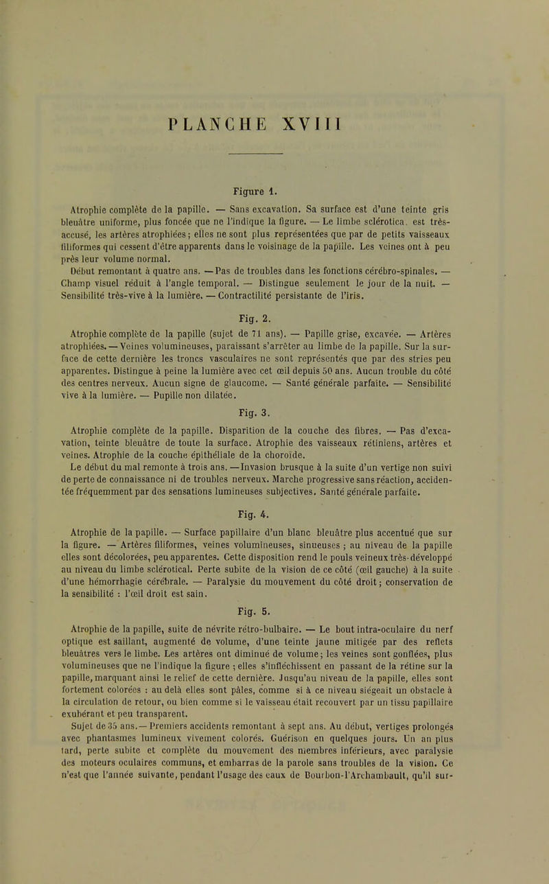 Figure 1. Atrophie complète delà papille. — Sans excavation. Sa surface est d'une teinte gris bleuâtre uniforme, plus foncée que ne l'indique la figure. — Le limbe sclérotica. est très- accusé, les artères atrophiées; elles ne sont plus représentées que par de petits vaisseaux filiformes qui cessent d'être apparents dans le voisinage de la papille. Les veines ont à peu près leur volume normal. Début remontant à quatre ans. —Pas de troubles dans les fonctions cérébro-spinales. — Champ visuel réduit à l'angle temporal. — Distingue seulement le jour de la nuit. — Sensibilité très-vive à la lumière. — Contractilité persistante de l'iris. Fig. 2. Atrophie complète de la papille (sujet de 71 ans). — Papille grise, excavée. — Arlères atrophiées. — Veines volumineuses, paraissant s'arrêter au limbe de la papille. Sur la sur- face de cette dernière les troncs vasculaires ne sont représentés que par des stries peu apparentes. Distingue à peine la lumière avec cet œil depuis 50 ans. Aucun trouble du côté des centres nerveux. Aucun signe de glaucome. — Santé générale parfaite. — Sensibilité vive à la lumière. — Pupille non dilatée. Fig. 3. Atrophie complète de la papille. Disparition de la couche des fibres. — Pas d'exca- vation, teinte bleuâtre de toute la surface. Atrophie des vaisseaux rétiniens, artères et veines. Atrophie de la couche épithéliale de la choroïde. Le début du mal remonte à trois ans. —Invasion brusque à la suite d'un vertige non suivi de perte de connaissance ni de troubles nerveux. Marche progressive sans réaction, acciden- tée fréquemment par des sensations lumineuses subjectives. Santé générale parfaite. Fig. 4. Atrophie de la papille. — Surface papillaire d'un blanc bleuâtre plus accentué que sur la figure. — Artères filiformes, veines volumineuses, sinueuses ; au niveau de la papille elles sont décolorées, peu apparentes. Cette disposition rend le pouls veineux très-développé au niveau du limbe sclérotical. Perte subite de la vision de ce côté (œil gauche) à la suite d'une hémorrhagie cérébrale. — Paralysie du mouvement du côté droit ; conservation de la sensibilité : l'œil droit est sain. Fig. 5. Atrophie de la papille, suite de névrite rétro-bulbaire. — Le bout intra-oculaire du nerf optique est saillant, augmenté de volume, d'une teinte jaune mitigée par des reflets bleuâtres vers le limbe. Les artères ont diminué de volume ; les veines sont gonflées, plus volumineuses que ne l'indique la figure ; elles s'infléchissent en passant de la rétine sur la papille,marquant ainsi le relief de cette dernière. Jusqu'au niveau de la papille, elles sont fortement colorées : au delà elles sont pâles, comme si à ce niveau siégeait un obstacle à la circulation de retour, ou bien comme si le vaisseau était recouvert par un tissu papillaire exubérant et peu transparent. Sujet de 35 ans.—Premiers accidents remontant à sept ans. Au début, vertiges prolongés avec phantasmes lumineux vivement colorés. Guérison en quelques jours. Un an plus lard, perte subite et complète du mouvement des membres inférieurs, avec paralysie des moteurs oculaires communs, et embarras de la parole sans troubles de la vision. Ce n'c3tque l'année suivante, pendant l'usage des eaux de Bouibon-l'Arthambault, qu'il sur-