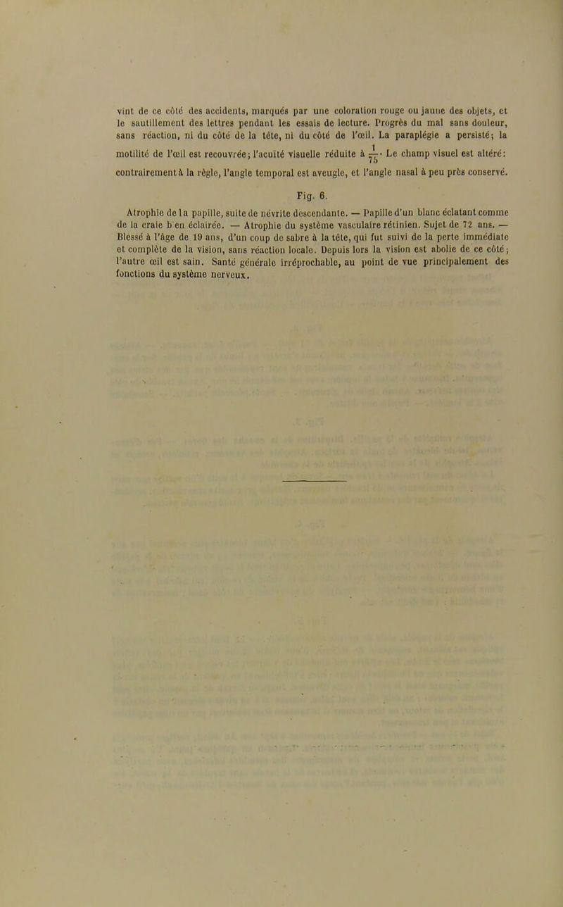 vint de ce cote des accidents, marques par une coloration rouge ou jaune des objets, et le sautillement des lettres pendant les essais de lecture. Progrès du mal sans douleur, sans réaction, ni du côté de la tête, ni du côté de l'œil. La paraplégie a persisté; la motilité de l'œil est recouvrée; l'acuité visuelle réduite à Le champ visuel est altéré: contrairement à la règlo, l'angle temporal est aveugle, et l'angle nasal à peu près conservé. Fig. 6. Atrophie de 1 a papille, suite de névrite descendante. — Papille d'un blanc éclatant comme de la craie b en éclairée. — Atrophie du système vasculaire rétinien. Sujet de 72 ans. — Blessé à l'âge de 19 ans, d'un coup de sabre à la téte, qui fut suivi de la perte immédiate et complète de la vision, sans réaction locale. Depuis lors la vision est abolie de ce côté; l'autre œil est sain. Santé générale irréprochable, au point de vue principalement des fonctions du système nerveux.