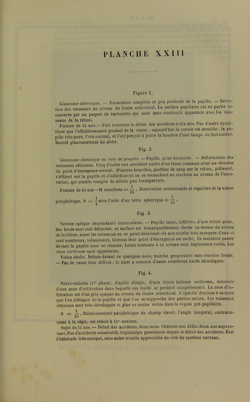 Figure 1. Glaucome chronique. - Excavation complète et peu profonde de la papille. - Dévia- tion des vaisseaux au niveau du limbe sclérotical. La surface papillaire est en partie re- couverte par un paquet de varicosités qui sont sans continuité apparente avec les vais- seaux de la rétine. Femme de 45 ans.- Fait remonter le début des accidents à dix ans. Pas d autre symp- tôme que raffaiblissement graduel de la vision : aujourd'hui la cornée est sensible ; la pu- pille très-pure, l'iris normal, et l'œil perçoit à peine la lumière d'une lampe de fort calibre. Dureté glaucomateuse du globe. Fig. 2. Glaucome chronique en voie de progrès. - Papille grise décolorée. - Déformation des vaisseaux rétiniens. Cinq d'entre eux semblent naître d'un tronc commun situé au-dessous du point d'émergence central. D'autres branches, gonflées de sang sur la rétine, palissent, s'efûlent sur la papille, et s'infléchissent ou se recouchent en crochets au niveau de l'exca- vation, qui semble remplie de débris peu transparents. Femme de 45 ans-H manifeste = ^ . Diminution considérable et régulière de la vision 1 , 1 périphérique. S = - avec l'aide d'un verre sphenque + — . Fig. 3. Névrite optique descendante' monoculaire. — Papille large, infiltrée, d'une teinte grise. Ses bords sont mal délimités, sa surface est remarquablement élevée au-dessus du niveau de la rétine; aussi les vaisseaux en ce point décrivent-ils une courbe très-marquée. Ceux-ci sont nombreux, volumineux. Comme leur point d'émergence est caché, ils semblent passer devant la papille sans en émaner. Leurs contours à ce niveau sont légèrement voilés. Les venœ vorticosœ sont apparentes. Vision abolie. Débuts datant de quelques mois, marche progressive sans réaction locale. — Pas de cause bien définie : le sujet a commis d'assez nombreux excès alcooliques. Fig. 4. Névro-rétinite (1M phase). Papille élargie, d'une teinte laiteuse uniforme, entourée d'une zone d'infiltration dans laquelle ses bords se perdent complètement. La zone d'in- filtration est d'un gris opaque au niveau du limbe sclérotical. L'opacité diminue à mesure que l'on s'éloigne de la papille et que l'on se rapproche des parties saines. Les vaisseaux rétiniens sont très-développés et plus ou moins voilés dans la région pré-papillaire. g — L , Rétrécissement périphérique du champ visuel ; l'angle temporal, contraire- ment à la règle, est réduit à 15° environ. Sujet de 32 ans. — Début des accidents, deux mois. Chancre non défini deux ans aupara^ vant.Pas d'accidents consécutifs. Céphalalgie persistante depuis le début des accidents. État d'hébétude très-marqué, sans autre trouble appréciable du côté du système nerveux.