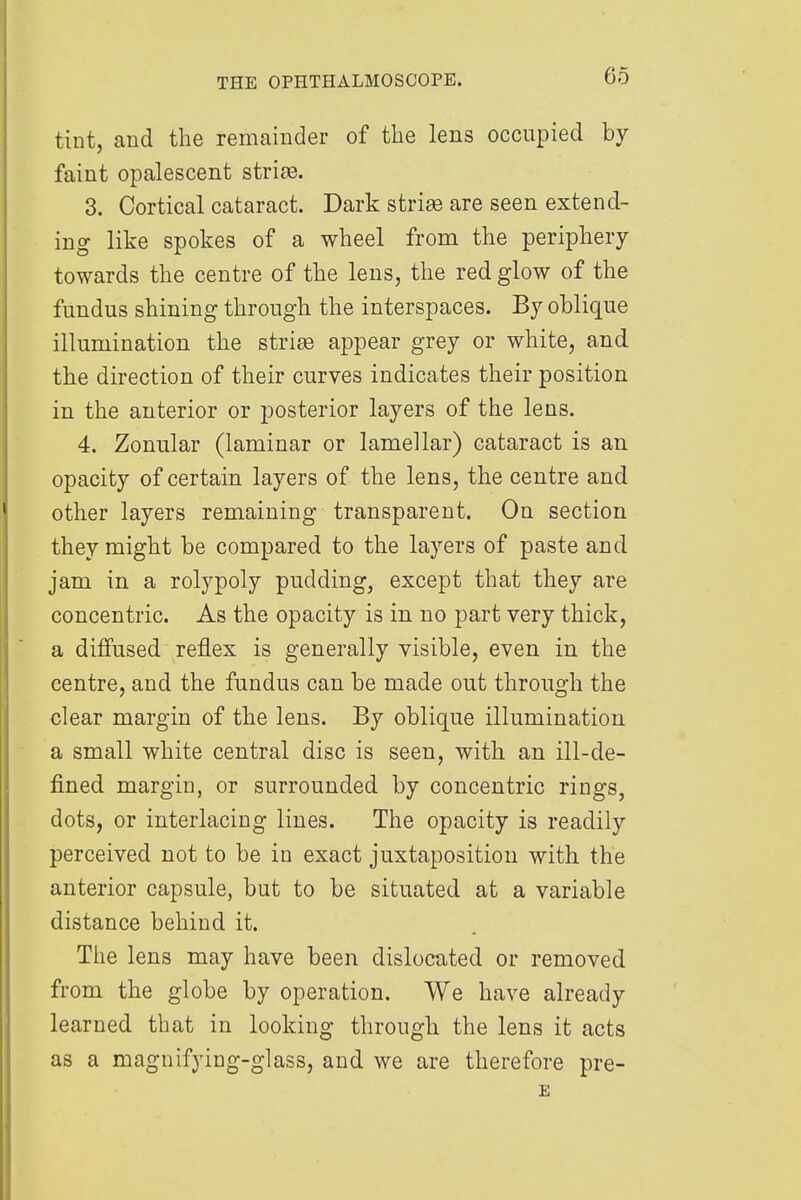 tint, and the remainder of the lens occupied by faint opalescent striaa. 3. Cortical cataract. Dark striae are seen extend- ing like spokes of a wheel from the periphery towards the centre of the lens, the red glow of the fundus shining through the interspaces. By oblique illumination the strise appear grey or white, and the direction of their curves indicates their position in the anterior or posterior layers of the lens. 4. Zonular (laminar or lamellar) cataract is an opacity of certain layers of the lens, the centre and other layers remaining transparent. On section they might be compared to the layers of paste and jam in a rolypoly pudding, except that they are concentric. As the opacity is in no part very thick, a diffused reflex is generally visible, even in the centre, and the fundus can be made out through the clear margin of the lens. By oblique illumination a small white central disc is seen, with an ill-de- fined margin, or surrounded by concentric rings, dots, or interlacing lines. The opacity is readily perceived not to be in exact juxtaposition with the anterior capsule, but to be situated at a variable distance behind it. The lens may have been dislocated or removed from the globe by operation. We have already learned that in looking through the lens it acts as a magnifying-glass, and we are therefore pre- E