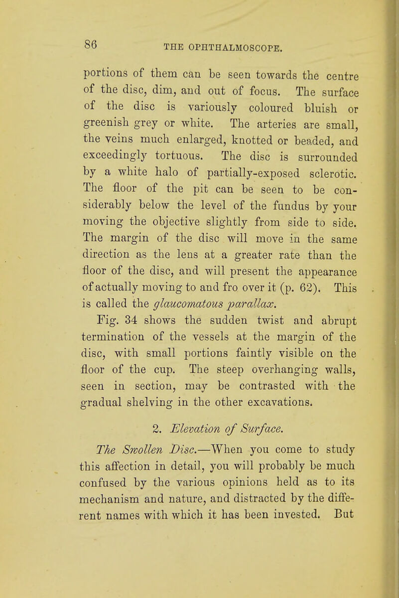 portions of them can be seen towards the centre of the disc, dim, and out of focus. The surface of the disc is variously coloured bluish or greenish grey or white. The arteries are small, the veins much enlarged, knotted or beaded, and exceedingly tortuous. The disc is surrounded by a white halo of partially-exposed sclerotic. The floor of the pit can be seen to be con- siderably below the level of the fundus by your moving the objective slightly from side to side. The margin of the disc will move in the same direction as the lens at a greater rate than the floor of the disc, and will present the appearance of actually moving to and fro over it (p. 62). This is called the glaucomatous -parallax. Fig. 34 shows the sudden twist and abrupt termination of the vessels at the margin of the disc, with small portions faintly visible on the floor of the cup. The steep overhanging walls, seen in section, may be contrasted with the gradual shelving in the other excavations. 2. Elevation of Surface. The Swollen Disc.—When you come to study this affection in detail, you will probably be much confused by the various opinions held as to its mechanism and nature, and distracted by the diffe- rent names with which it has been invested. But