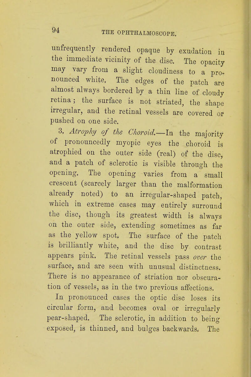 unfrequently rendered opaque by exudation in the immediate vicinity of the disc. The opacity may vary from a slight cloudiness to a pro- nounced white. The edges of the patch are almost always bordered by a thin line of cloudy retina; the surface is not striated, the shape irregular, and the retinal vessels are covered or pushed on one side. 3. Atrophy of the Choroid.—In the majority of pronouncedly myopic eyes the choroid is atrophied on the outer side (real) of the disc, and a patch of sclerotic is visible through the opening. The opening varies from a small crescent (scarcely larger than the malformation already noted) to an irregular-shaped patch, which in extreme cases may entirely surround the disc, though its greatest width is always on the outer side, extending sometimes as far as the yellow spot. The surface of the patch is brilliantly white, and the disc by contrast appears pink. The retinal vessels pass over the surface, and are seen with unusual distinctness. There is no appearance of striation nor obscura- tion of vessels, as in the two previous affections. In pronounced cases the optic disc loses its circular form, and becomes oval or irregularly pear-shaped. The sclerotic, in addition to being exposed, is thinned, and bulges backwards. The