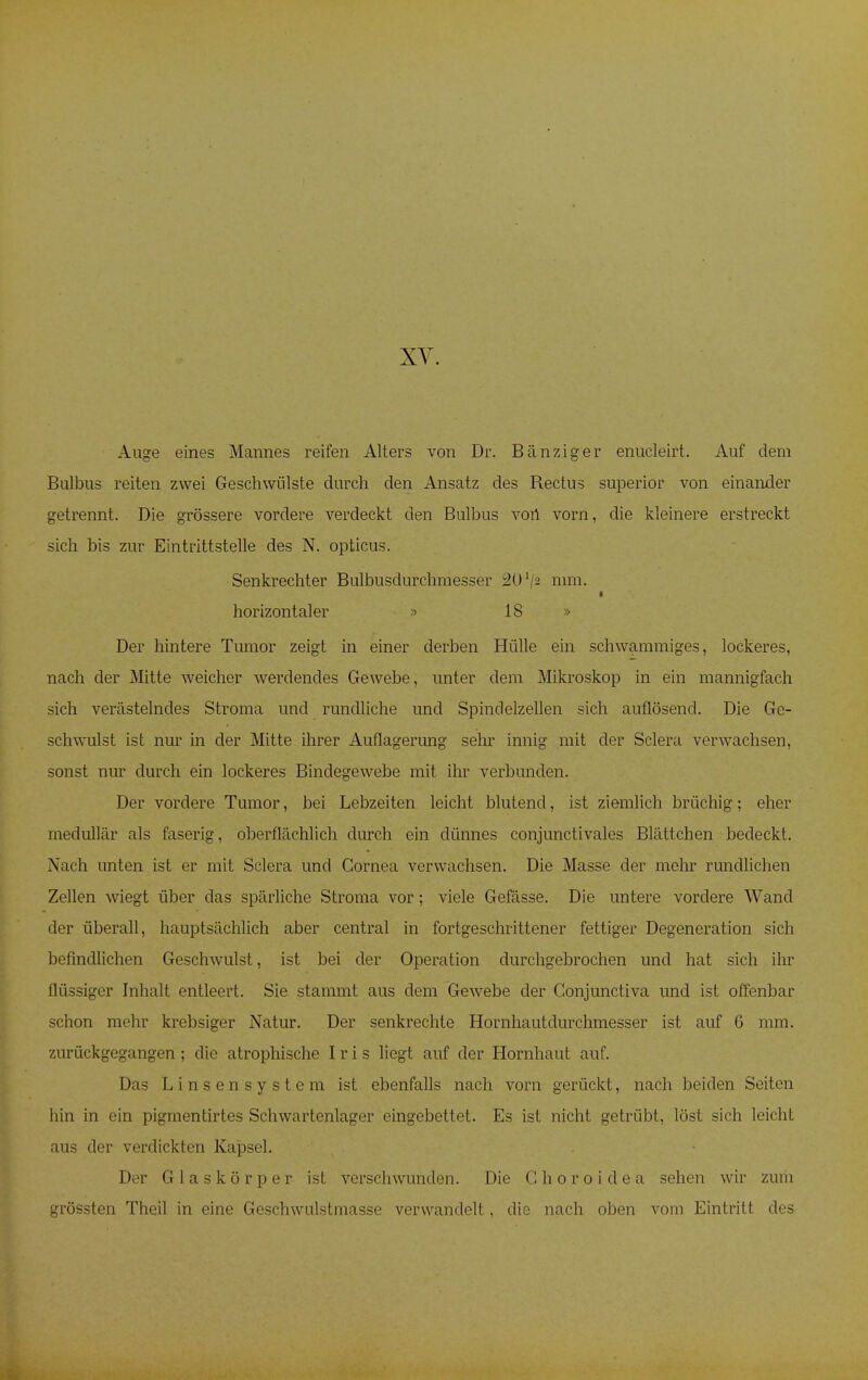 Auge eines Mannes reifen Alters von Dr. Bänziger enucleirt. Auf dem Baibus reiten zwei Geschwülste durch den Ansatz des Rectus superior von einander getrennt. Die grössere vordere verdeckt den Bulbus von vorn, die kleinere erstreckt sich bis zur Eintrittstelle des N. opticus. Senkrechter Bulbusdurchmesser i2U V2 min. horizontaler » 18 » Der hintere Tumor zeigt in einer derben Hülle ein schwammiges, lockeres, nach der Mitte weicher werdendes Gewebe, unter dem Mikroskop in ein mannigfach sich verästelndes Stroma und rundliche und Spinclelzellen sich auflösend. Die Ge- schwulst ist nur in der Mitte ihrer Auflagerung sehr innig mit der Sclera verwachsen, sonst nur durch ein lockeres Bindegewebe mit ihr verbunden. Der vordere Tumor, bei Lebzeiten leicht blutend, ist ziemlich brüchig; eher medullär als faserig, oberflächlich durch ein dünnes conjunctivales Blättchen bedeckt. Nach unten ist er mit Sclera und Cornea verwachsen. Die Masse der mehr rundlichen Zellen wiegt über das spärliche Stroma vor; viele Gefässe. Die untere vordere Wand der überall, hauptsächlich aber central in fortgeschrittener fettiger Degeneration sich befindlichen Geschwulst, ist bei der Operation durchgebrochen und hat sich ihr flüssiger Inhalt entleert. Sie stammt aus dem Gewebe der Conjunctiva und ist offenbar schon mehr krebsiger Natur. Der senkrechte Hornhautdurchmesser ist auf 6 mm. zurückgegangen; die atrophische Iris liegt auf der Hornhaut auf. Das Linsensystem ist ebenfalls nach vorn gerückt, nach beiden Seiten hin in ein pigmentirtes Schwartenlager eingebettet. Es ist nicht getrübt, löst sich leicht aus der verdickten Kapsel. Der Glaskörper ist verschwunden. Die G h o r o i d e a sehen wir zum grössten Theil in eine Geschwulstmasse verwandelt, die nach oben vom Eintritt des