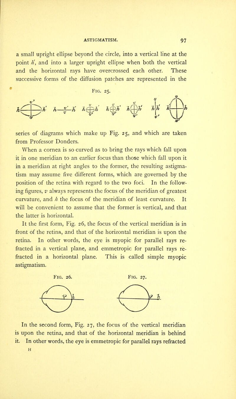 a small upright ellipse beyond the circle, into a vertical line at the point k', and into a larger upright ellipse when both the vertical and the horizontal rays have overcrossed each other. These successive forms of the diffusion patches are represented in the Fig. 25. series of diagrams which make up Fig. 25, and which are taken from Professor Donders. When a cornea is so curved as to bring the rays which fall upon it in one meridian to an earlier focus than those which fall upon it in a meridian at right angles to the former, the resulting astigma- tism may assume five different forms, which are governed by the position of the retina with regard to the two foci. In the follow- ing figures, v always represents the focus of the meridian of greatest curvature, and h the focus of the meridian of least curvature. It will be convenient to assume that the former is vertical, and that the latter is horizontal. It the first form, Fig. 26, the focus of the vertical meridian is in front of the retina, and that of the horizontal meridian is upon the retina. In other words, the eye is myopic for parallel rays re- fracted in a vertical plane, and emmetropic for parallel rays re- fracted in a horizontal plane. This is called simple myopic astigmatism. Fig. 26. Fig. 27. In the second form, Fig. 27, the focus of the vertical meridian is upon the retina, and that of the horizontal meridian is behind it. In other words, the eye is emmetropic for parallel rays refracted H