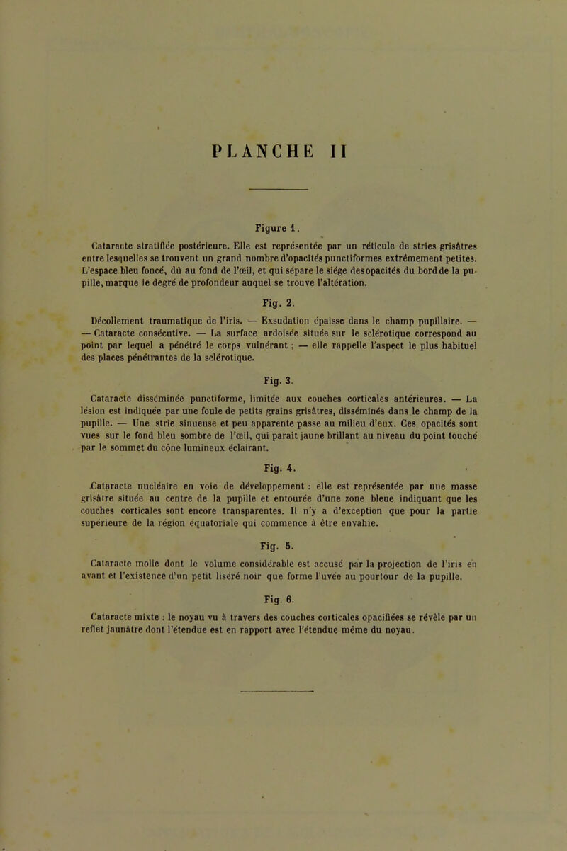 Figure 1. Cataracte stratiflée postérieure. Elle est représentée par un réticule de stries grisâtres entre lesquelles se trouvent un grand nombre d'opacités punctiformes extrêmement petites. L'espace bleu foncé, dû au fond de l'œil, et qui sépare le siège desopacités du bordde la pu- pille, marque le degré de profondeur auquel se trouve l'altération. Fig. 2. Décollement traumatique de l'iris. — Exsudation épaisse dans le champ pupillaire. — — Cataracte consécutive. — La surface ardoisée située sur le sclérotique correspond au point par lequel a pénétré le corps vulnérant ; — elle rappelle l'aspect le plus habituel des places pénétrantes de la sclérotique. Fig. 3. Cataracte disséminée punctiforme, limitée aux couches corticales antérieures. — La lésion est indiquée par une foule de petits grains grisâtres, disséminés dans le champ de la pupille. — Une strie sinueuse et peu apparente passe au milieu d'eux. Ces opacités sont vues sur le fond bleu sombre de l'œil, qui parait jaune brillant au niveau du point touché par le sommet du cône lumineux éclairant. Fig. 4. .Cataracte nucléaire en voie de développement : elle est représentée par une masse grisâtre située au centre de la pupille et entourée d'une zone bleue indiquant que les couches corticales sont encore transparentes. Il n'y a d'exception que pour la partie supérieure de la région équatoriale qui commence à être envahie. Fig. 5. Cataracte molle dont le volume considérable est accusé par la projection de l'iris en avant et l'existence d'un petit liséré noir que forme l'uvée au pourtour de la pupille. Fig. 6. Cataracte mixte : le noyau vu à travers des couches corticales opacifiées se révèle par un reflet jaunâtre dont l'étendue est en rapport avec l'étendue même du noyau.