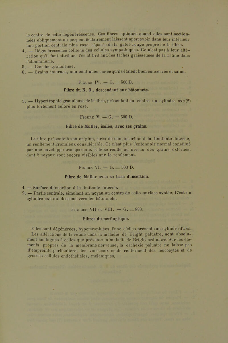 le centre de cette dégénérescence. Ces fibres optiques quand elles sont section- nées obliquement ou perpendî'culairement laissent apercevoir dans leur intérieur une portion centrale plus rose, séparée de la gaine rouge propre de la fibre. 4. Dégénérescence colloïde des cellules sympathiques. Ce n'est pas à leur alté- ration qu'il faut attribuer l'éclat brillant,des taches graisseuses de la rétine dans l'albuminurie. 5. — Couche granuleuse. 6. — Grains internes, non continués par ce qu'ils étaient bien conservés et sains. Figure IV. — G. = 500 D. Fibre du N. 0., descendant aux bâtonnets. 1. — Hypertrophie granuleuse de la fibre, présentant au centre un cylindre axe (2) plus fortement coloré en rose. Figure V. — G. = 500 D. Fibre de MuUer, isolée, avec ses grains. La fibre présente à son origine, près de son insertion à la limitante interne, un renflement granuleux considérable. Ce n'est plus l'entonnoir normal conslilué par une enveloppe transparente. Elle se renfle au niveau des grains externes, dont 2 noyaux sont encore visibles sur le renflement. Figure VI. — G. = 500 D. Fibre de MùUer avec sa base d'insertion. 1. — Surface d'insertion à la limitante interne. 2. — Partie centrale, simulant un noyau au centre de cette surface ovoïde. C'est un cylindre axe qui descend vers les bâtonnets. Figures VII et VIII. — G. =888. Fibres du nerf optique. Elles sont dégénérées, hypertrophiées, l'une d'elles présente un cylindre d'acre. Les altérations do la rétine dans la maladie de Bright palustre, sont absolu- ment analogues à celles que présente la maladie de Bright ordinaire. Sur les élé- ments propres de la membrane nerveuse, la cachexie palustre ne laisse pas d'empreinte particulière, les vaisseaux seuls renferment des leucocytes et do grosses cellules endothéliales, mélaniques.