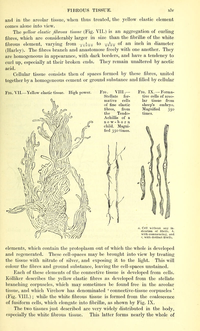 and in the areolar tissue, when thus treated, the yellow elastic element comes alone into view. The yellow elastic fibrous tissue (Fig. VII.) is an aggregation of curling fibres, which are considerably larger in size than the fibrillae of the white fibrous element, varying from ^ to ^ of an inch in diameter (Harley). The fibres branch and anastomose freely with one another. They are homogeneous in appearance, with dark borders, and have a tendency to curl up, especially at their broken ends. They remain unaltered by acetic acid. Cellular tissue consists then of spaces formed by these fibres, united together by a homogeneous cement or ground substance and filled by cellular Fig. VII.—Yellow elastic tissue. High power. Fig. VIII.— Fig. IX. —Forma- Stellate for- tive cells of areo- mative cells lar tissue from of fine elastic sheep's embryo, fibres, from Magnified 350 the Tendo- times. Achillis of a new-born elements, which contain the protoplasm out of which the whole is developed and regenerated. These cell-spaces may be brought into view by treating the tissue with nitrate of silver, and exposing it to the light. This will colour the fibres and ground substance, leaving the cell-spaces unstained. Each of these elements of the connective tissue is developed from cells. Kolliker describes the yellow elastic fibres as developed from the stellate branching corpuscles, which may sometimes be found free in the areolar tissue, and which Virchow has denominated ' connective-tissue corpuscles ' (Fig. VIII.); while the white fibrous tissue is formed from the coalescence of fusiform cells, which elongate into fibrillae, as shown by Fig. IX. The two tissues just described are very widely distributed in the body, especially the white fibrous tissue. This latter forms nearly the whole of