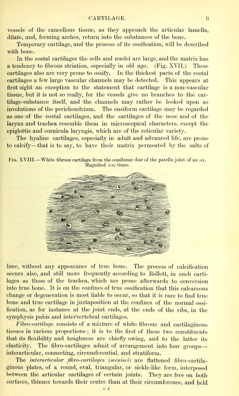 vessels of the cancellous tissue, as they approach the articular lamella, dilate, and, forming arches, return into the substances of the bone. Temporary cartilage, and the process of its ossification, will be described with bone. In the costal cartilages the cells and nuclei are large, and the matrix has a tendency to fibrous striation, especially in old age. (Fig. XVII.) These cartilages also are very prone to ossify. In the thickest parts of the costal cartilages a few large vascular channels may be detected. This appears at first sight an exception to the statement that cartilage is a non-vascular tissue, but it is not so really, for the vessels give no branches to the car- tilage-substance itself, and the channels may rather be looked upon as involutions of the perichondrium. The ensiform cartilage may be regarded as one of the costal cartilages, and the cartilages of the nose and of the larynx and trachea resemble them in microscopical characters, except the epiglottis and cornicula laryngis, which are of the reticular variety. The hyaline cartilages, especially in adult and advanced life, are prone to calcify—that is to say, to have their matrix permeated by the salts of Fig. XVIII.—White ribrous cartilagre from the semilunar disc of the patella joint of an ox. Magnified 100 times. lime, without any appearance of true bone. The process of calcification occurs also, and still more frequently according to Eollett, in such carti- lages as those of the trachea, which are prone afterwards to conversion into true bone. It is on the confines of true ossification that this calcareous change or degeneration is most liable to occur, so that it is rare to find true bone and true cartilage in juxtaposition at the confines of the normal ossi- fication, as for instance at the joint ends, at the ends of the ribs, in the symphysis pubis and intervertebral cartilages. Fibro-cartilage consists of a mixture of white fibrous and cartilaginous tissues in various proportions ; it is to the first of these two constituents that its flexibility and toughness are chiefly owing, and to the latter its elasticity. The fibro-cartilages admit of arrangement into four groups— interarticular, connecting, circumferential, and stratiform. The interarticular Jibro-cartilages (menisci) are flattened fibro-cartila- ginous plates, of a round, oval, triangular, or sickle-like form, interposed between the articular cartilages of certain joints. They are free on both surfaces, thinner towards their centre than at their circumference, and held C 2
