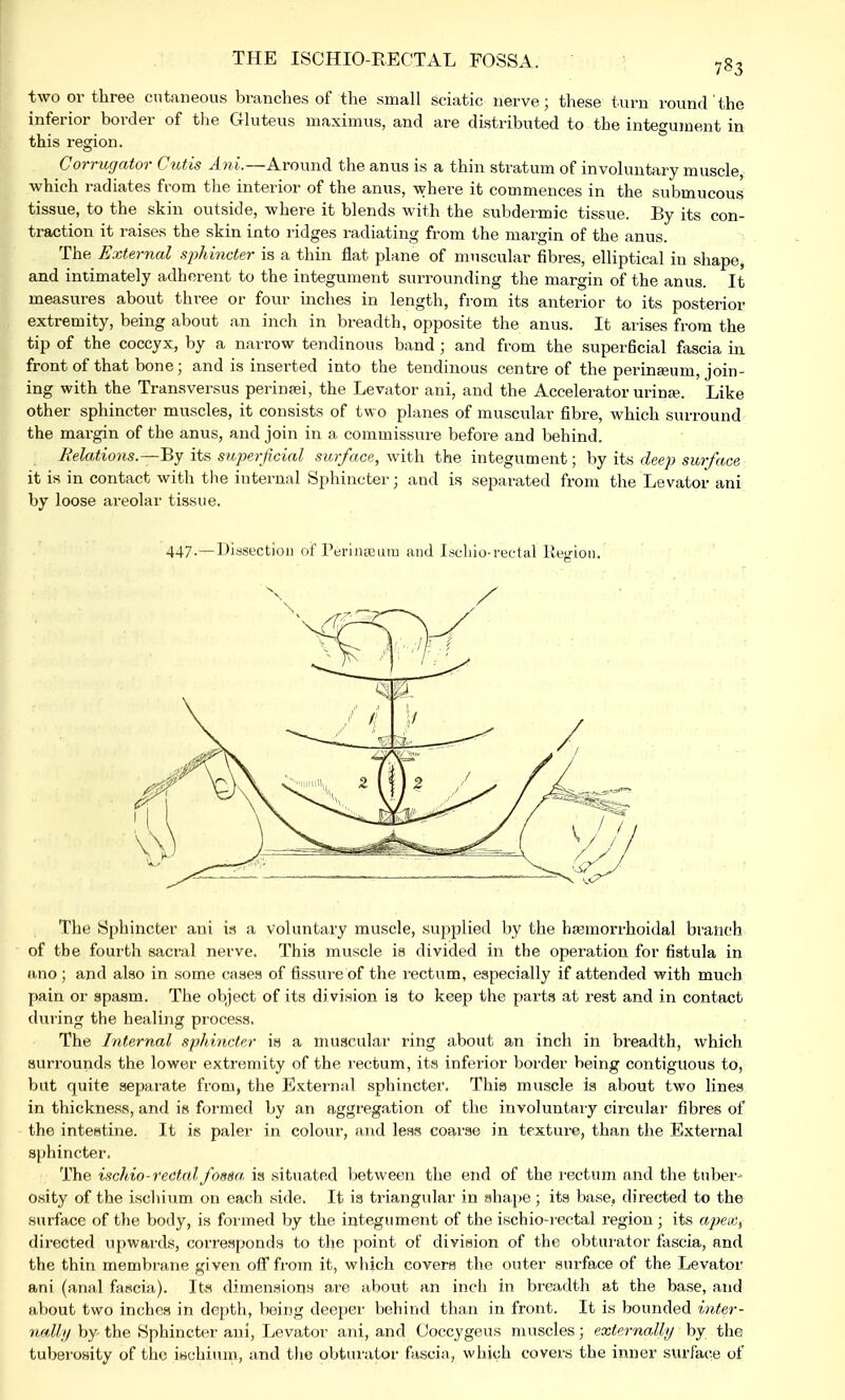 two or three cutaneous branches of the small sciatic nerve; these turn round the inferior border of the Gluteus maximus, and are distributed to the integument in this region. Corrugator Cutis Ani.—Around the anus is a thin stratum of involuntary muscle, which radiates from the interior of the anus, where it commences in the submucous tissue, to the skin outside, where it blends with the subdermic tissue. By its con- traction it raises the skin into ridges radiating from the margin of the anus. The External sphincter is a thin flat plane of muscular fibres, elliptical in shape, and intimately adherent to the integument surrounding the margin of the anus. It measures about three or four inches in length, from its anterior to its posterior extremity, being about an inch in breadth, opposite the anus. It arises from the tip of the coccyx, by a narrow tendinous band ; and from the superficial fascia in front of that bone; and is inserted into the tendinous centre of the perineeum, join- ing with the Transversus perinsei, the Levator ani, and the Accelerator urinse. Like other sphincter muscles, it consists of two planes of muscular fibre, which surround the margin of the anus, and join in a commissure before and behind. Relations.—By its superficial surface, with the integument; by its deep surface it is in contact with the internal Sphincter; and is separated from the Levator ani by loose areolar tissue. 447-—Dissection of Perineum and Lcliio-rectal Region. The Sphincter ani is a voluntary muscle, supplied by the hemorrhoidal branch of the fourth sacral nerve. This muscle is divided in the operation for fistula in anoj and also in some cases of fissure of the rectum, especially if attended with much pain or spasm. The object of its division is to keep the parts at rest and in contact during the healing process. The Internal sphincter is a muscular ring about an inch in breadth, which surrounds the lower extremity of the rectum, its inferior border being contiguous to, but quite separate from, the External sphincter. This muscle is about two lines in thickness, and is formed by an aggregation of the involuntary circular fibres of the intestine. It is paler in colour, and less coarse in texture, than the External sphincter. The ischio-rectal foesa is situated between the end of the rectum and the tuber- osity of the ischium on each side. It is triangular in shape ; its base, directed to the surface of the body, is formed by the integument of the ischio-rectal region ; its apea, directed upwards, corresponds to the point of division of the obturator fascia, and the thin membrane given off from it, which covers the outer surface of the Levator ani (anal fascia). Its dimensions are about an inch in breadth at the base, and about two inches in depth, being deeper behind than in front. It is bounded inter- nally by the Sphincter ani, Levator ani, and Ooccygeus muscles; externally by the tuberosity of the ischium, and the obturator fascia, which covers the inner surface of