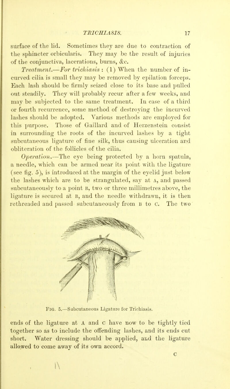 surface of the lid. Sometimes they are due to contraction of the sphincter orbicularis. They may be the result of injuries of the conjunctiva, lacerations, burns, &c. Treatment.—For trichiasis : (1) When the number of in- curved cilia is small they may be removed by ej^ilation forceps. Each lash should be firmly seized close to its base and pulled out steadily. They will probably recur after a few weeks, and may be subjected to the same treatment. In case of a third or fourth recurrence, some method of destroying the incurved lashes should be adopted. Various methods are employed for this purpose. Those of Graillard and of Herzenstein consist in surrounding the roots of the incurved lashes by a tight subcutaneous ligature of fine silk, thus causing ulceration and obliteration of the follicles of the cilia. Operation.—The eye being protected by a horn spatula, a needle, which can be armed near its point with the ligature (see fig. 5), is introduced at the margin of the eyelid just below the lashes which are to be strangulated, say at A, and passed subcutaneously to a point B, two or three millimetres above, the ligature is secured at B, and the needle withdrawn, it is then rethreaded and passed subcutaneously from B to c. The two Fig. 5.—Subcutaneous Ligature for Trichiasis. ends of the ligature at A and C have now to be tightly tied together so as to include the offending lashes, and its ends cut short. Water dressing should be applied, and the ligature allowed to come away of its own accord. c