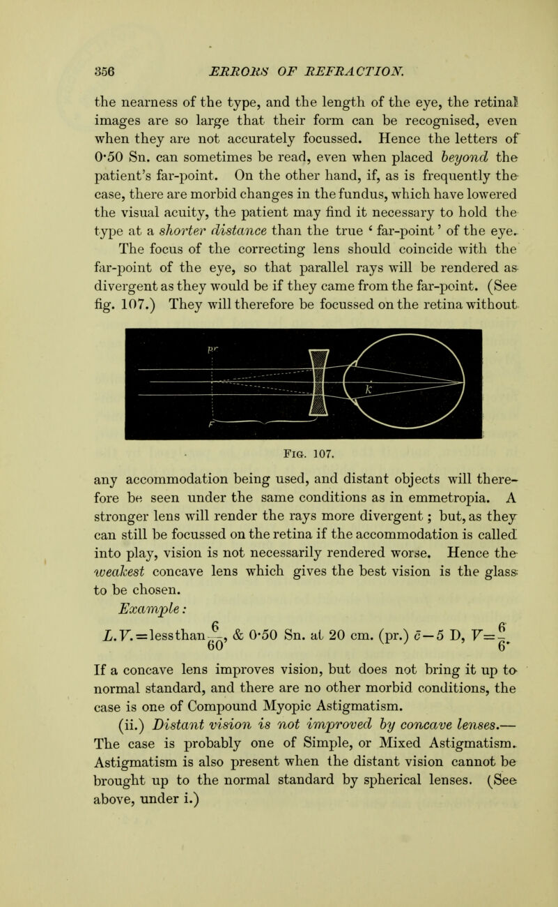 the nearness of the type, and the length of the eye, the retinal images are so large that their form can be recognised, even when they are not accurately focussed. Hence the letters of 0*50 Sn. can sometimes be read, even when placed beyond the patient's far-point. On the other hand, if, as is frequently the- case, there are morbid changes in the fundus, which have lowered the visual acuity, the patient may find it necessary to hold the type at a shorter distance than the true ' far-point' of the eye. The focus of the correcting lens should coincide with the far-j)oint of the eye, so that parallel rays will be rendered as- divergent as they would be if they came from the far-point. (See fig. 107.) They will therefore be focussed on the retina without Fig. ]07. any accommodation being used, and distant objects will there- fore be seen under the same conditions as in emmetropia. A stronger lens will render the rays more divergent; but, as they can still be focussed on the retina if the accommodation is called into play, vision is not necessarily rendered worse. Hence the- lueakest concave lens which gives the best vision is the glass; to be chosen. Example : i.F. = lessthanA, & 0-50 Sn. at 20 cm. (pr.) c-5 D, F=g^ If a concave lens improves visiou, but does not bring it up to- normal standard, and there are no other morbid conditions, the case is one of Compound Myopic Astigmatism. (ii.) Distant vision is not improved by concave lenses,— The case is probably one of Simple, or Mixed Astigmatism.. Astigmatism is also present when the distant vision cannot be brought up to the normal standard by spherical lenses. (See above, under i.)