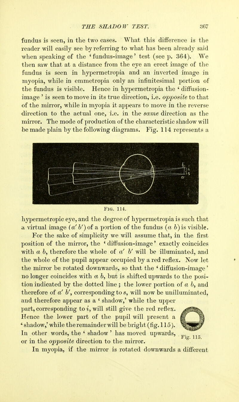 fundus is seen, in the two cases. What this difference is the reader will easily see by referring to what has been already said when speaking of the ' fundus-image' test (see p. 364). We then saw that at a distance from the eye an erect image of the fundus is seen in hypermetropia and an inverted image in myopia, while in emmetropia only an infinitesimal portion of the fundus is visible. Hence in hypermetropia the ' diffusion- image ' is seen to move in its true direction, i.e. opposite to that of the mirror, while in myopia it appears to move in the reverse •direction to the actual one, i.e. in the same direction as the mirror. The mode of production of the characteristic shadow will be made plain by the following diagrams. Fig. 114 represents a Fig. 114. hypermetropic eye, and the degree of hypermetropia is such that a virtual image (a'6') of a portion of the fundus {a b)is visible. For the sake of simplicity we will assume that, in the first position of the mirror, the ' diffusion-image' exactly coincides with a b, therefore the whole of U will be illuminated, and the whole of the pupil appear occupied by a red reflex. Now let the mirror be rotated downwards, so that the ' diffusion-image' no longer coincides with a 6, but is shifted upwards to the posi- tion indicated by the dotted line ; the lower portion of a b, and therefore of b\ corresponding to s, will now be unilluminated, and therefore appear as a ' shadow,' while the upper part, corresponding to will still give the red reflex. Hence the lower part of the pupil will present a ' shadow,' while the remainder will be bright (fig. 115). In other words, the ' shadow ' has moved upwards, or in the opposite direction to the mirror. In myopia, if the mirror is rotated downwards a different