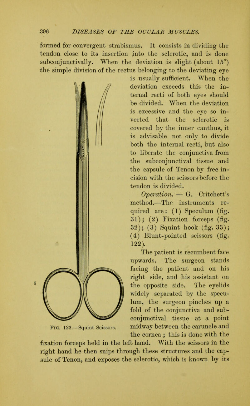 formed for convergent strabismus. It consists in dividing the tendon close to its insertion into the sclerotic, and is done subconjunctivallj. When the deviation is slight (about 15°) the simple division of the rectus belonging to the deviating eye is usually sufficient. When the deviation exceeds this the in- ternal recti of both eyes should be divided. When the deviation is excessive and the eye so in- verted that the sclerotic is covered by the inner canthus, it is advisable not only to divide both the internal recti, but also to liberate the conjunctiva from the subconjunctival tissue and the capsule of Tenon by free in- cision with the scissors before the tendon is divided. Operation, — G-. Critchett's method.—The instruments re- quired are : (1) Speculum (fig. 31) ; (2) Fixation forceps (fig. 32) ; (3) Squint hook (fig. 33); (4) Blunt-pointed scissors (fig. 122). The patient is recumbent face upwards. The surgeon stands facing the patient and on his right side, and his assistant on the opposite side. The eyelids widely separated by the specu- lum, the surgeon pinches up a fold of the conjunctiva and sub- conjunctival tissue at a point midway between the caruncle and the cornea ; this is done with the fixation forceps held in the left hand. With the scissors in the right hand he then snips through these structures and the cap- sule of Tenon, and exposes the sclerotic, which is known by its Fig. 122.—Squint Scissors.