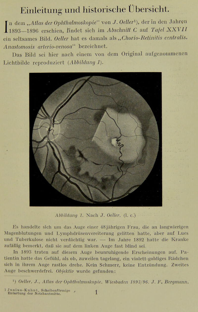 Einleitung und historische Übersicht. Jn dem „Attas der Ophthalmoskopie11 von J. Oeller1), der in den Jahren 1893—1896 erschien, findet sich im Abschnitt C auf Tafel XXVII ein seltsames Bild. Oeller hat es damals als.„Chorio-Retinitis centralis. Anastomosis arterio-venosa bezeichnet. Das Bild sei hier nach einem von dem Original aufgenommenen Lichtbilde reproduziert (Abbildung 1). Abbildung 1. Nach J. Oeller. (1. c.) Es handelte sich um das Auge einer 48jährigen Frau, die an langwierigen Magenblutungen und Lymphdrüsenvereiterung gelitten hatte, aber auf Lues und Tuberkulose nicht, verdächtig war. — Im Jahre 1892 hatte die Kranke zufällig bemerkt, daß sie auf dem linken Auge fast blind sei. In 1893 traten auf diesem Auge beunruhigende Erscheinungen auf. Pa- tientin hatte das Gefühl, als ob, zuweilen tagelang, ein violett-goldiges Rädchen sich in ihrem Auge rastlos drehe. Kein Schmerz, keine Entzündung. Zweites Auge beschwerdefrei. Objektiv wurde gefunden: l) Oeller. ./., Atlas der Ophthalmoskopie. Wiesbaden 1S93/96. J. F. Bergmann. 1 Junius-Kuhnt, Scheibenförmige , \