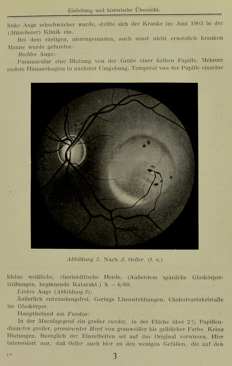 linke Auge sehschwächer wurde, stellte sich der Kranke im .Juni 1903 in der I Münchener) Klinik ein. Bei dem rüstigen, nierengesunden, auch sonst nicht erweislich kranken Manne wurde gefunden: Rechtes Auge: Paramacular eine Blutung von der Größe einer halben Papille. Mehrere andere Hämorrhagien in nächster Umgebung: Temporal von der Papille einzelne Abbildung 2. Nach J. Oeller. (1. c.) kleine weißliche, Chorioiditis che Herde. (Außerdem spärliche Glaskörper- trübungen, beginnende Katarakt.) S = 6/60. Linkes Auge (Abbildung 2): Äußerlich entzündungsfrei. Geringe Linsentrübungen. Cholestearinkristalle im Glaskörper. Hauptbefund am Fundus: In der Maculagcgend ein großer runder, in der Fläche über 2\'-> Papillen- diameter großer, prominenter Herd von grauweißer bis gelblicher Farbe. Keine Blutungen. Bezüglich der Einzelheiten sei auf das Original verwiesen. Hier interessiert nur, daß Oeller auch hier an den wenigen Gefäßen, die auf den