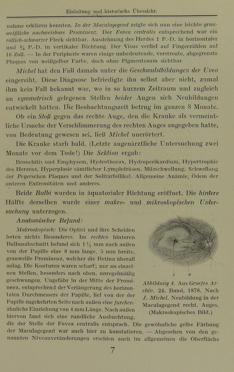 nähme erklären konnten. der Maculagegend zeigte sich nun eine leichte grau- weißliche nachweisbare Prominenz. Der Fovea centralis entsprechend war ein rötlich-schwarzer Fleck sichtbar. Ausdehnung des Herdes 1 P.-D. in horizontaler und % P.-D. in vertikaler Richtung. Der Visus verfiel auf Fingerzählen auf 16 Zoll. — In der Peripherie waren einige unbedeutende, verstreute, abgegrenzte Plaques von weißgelber Farbe, doch ohne Pigmentsaum sichtbar. Michel hat den Fall damals unter die Geschwulstbildungen der Uvea eingereiht. Diese Diagnose befriedigte ihn selbst aber nicht, zumal ihm kein Fall bekannt war, wo in so kurzem Zeitraum und zugleich an symmetrisch gelegenen Stellen beider Augen sich Neubildungen entwickelt hätten. D'ie Beobachtungszeit betrug im ganzen 8 Monate. Ob ein Stoß gegen das rechte Auge, den die Kranke als vermeint- liche Ursache der Verschlimmerung des rechten Auges angegeben hatte, von Bedeutung gewesen sei, ließ Michel unerörtert. Die Kranke starb bald. (Letzte augenärztliche Untersuchung zwei Monate vor dem Tode!) Die Sektion ergab: Bronchitis und Emphysem, Hydrothorax, Hydroperikardium, Hypertrophie des Herzens, Hyperplasie sämtlicher Lymphdrüsen, Milzschwellung, Schwellung der Peyerschcn Plaques und der Solitärfollikel. Allgemeine Anämie, Ödem der unteren Extremitäten und anderes. Beide Bulbi wurden in äquatorialer Richtung eröffnet. Die hintere Hälfte derselben wurde einer makro- und mikroskopischen Unter- suchung unterzogen. Anatomischer Befund: Makroskopisch: Die Optici und ihre Scheiden boten nichts Besonderes. Im rechten hinteren Bulbusabschnitt befand sich 1 % mm nach außen von der Papille eine 8 mm lange, 5 mm breite, \ grauweiße Prominenz, welcher die Retina überall anlag. Die Konturen waren scharf; nur an einzel- nen Stellen, besonders nach oben, unregelmäßig 3 a geschwungen. Ungefähr in der Mitte der Promi- AbMldung ^ Aus Graefes Ar_ nenz, entsprechend der Verlängerung des horizon- cMv 24 Band> 187g Nach talen Durchmessers der Papille, lief von der der j MicM Neubildung in der Papille zugekehrten Seite nach außen eine furchen- Maculagegend recht. Auges, ähnliche Einziehung von 4 mm Länge. Nach außen (Makroskopisches Bild.) hiervon fand sich eine rundliche Ausbuchtung, die der Stelle der Fovea centralis entsprach. Die gewöhnliche gelbe Färbung der Maculagegend war auch hier zu konstatieren. — Abgesehen von den ge- nannten Niveauveränderungen erschien auch im allgemeinen die Oberfläche