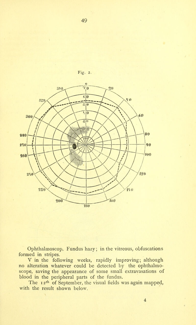 Ophthalmoscop. Fundus hazy; in the vitreous, obfuscations formed in stripes. V in the following weeks, rapidly improving; although no alteration whatever could be detected by the ophthalmo- scope, saving the appearance of some small extravasations of blood in the peripheral parts of the fundus. The 12th of September, the visual fields was again mapped, with the result shown below. 4