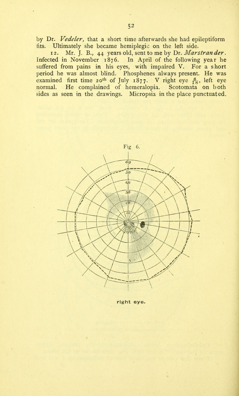 by Dr. Vedeler, that a short time afterwards she had epileptiform fits. Ultimately she became hemiplegic on the left side. 12. Mr. J. B., 44 years old, sent to me by Dr. Marstrander. Infected in November 1876. In April of the following year he suffered from pains in his eyes, with impaired V. For a short period he was almost blind. Phosphenes always present. He was examined first time 20th of July 1877. V right eye r6g, left eye normal. He complained of hemeralopia. Scotomata on both sides as seen in the drawings. Micropsia in the place punctuated. Fig 6. right eye.