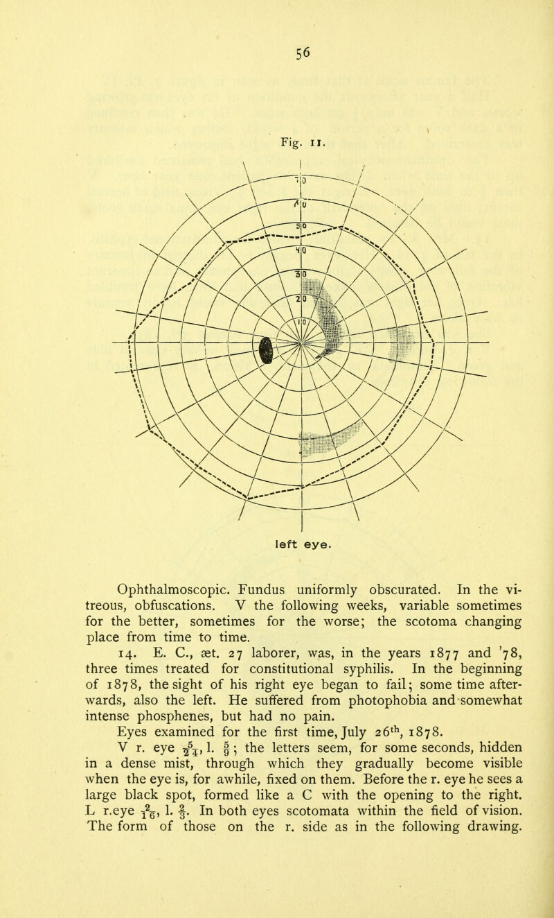 Fig. ii. left eye. Ophthalmoscopic. Fundus uniformly obscurated. In the vi- treous, obfuscations. V the following weeks, variable sometimes for the better, sometimes for the worse; the scotoma changing place from time to time. 14. E. C, aet. 27 laborer, was, in the years 1877 and '78, three times treated for constitutional syphilis. In the beginning of 1878, the sight of his right eye began to fail; some time after- wards, also the left. He suffered from photophobia and somewhat intense phosphenes, but had no pain. Eyes examined for the first time, July 26th, 1878. V r. eye -g5?, 1. §; the letters seem, for some seconds, hidden in a dense mist, through which they gradually become visible when the eye is, for awhile, fixed on them. Before the r. eye he sees a large black spot, formed like a C with the opening to the right. L r.eye j2^, 1. ■§. In both eyes scotomata within the field of vision. The form of those on the r. side as in the following drawing.