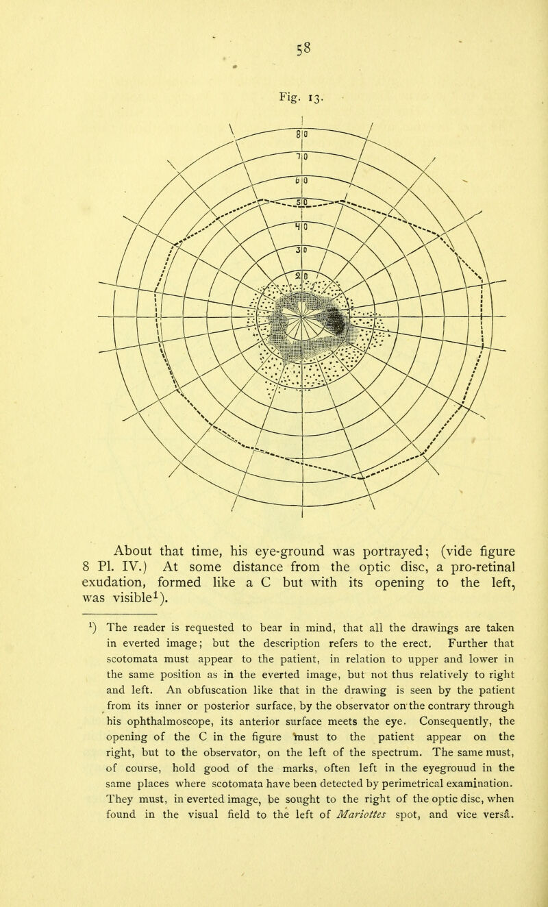 Fig. 13. About that time, his eye-ground was portrayed; (vide figure 8 PL IV.) At some distance from the optic disc, a pro-retinal exudation, formed like a C but with its opening to the left, was visible1). *) The reader is requested to bear in mind, that all the drawings are taken in everted image; but the description refers to the erect. Further that scotomata must appear to the patient, in relation to upper and lower in the same position as in the everted image, but not thus relatively to right and left. An obfuscation like that in the drawing is seen by the patient from its inner or posterior surface, by the observator on the contrary through his ophthalmoscope, its anterior surface meets the eye. Consequently, the opening of the C in the figure must to the patient appear on the right, but to the observator, on the left of the spectrum. The same must, of course, hold good of the marks, often left in the eyegrouud in the same places where scotomata have been detected by perimetrical examination. They must, in everted image, be sought to the right of the optic disc, when found in the visual field to the left of Mariottes spot, and vice versa.