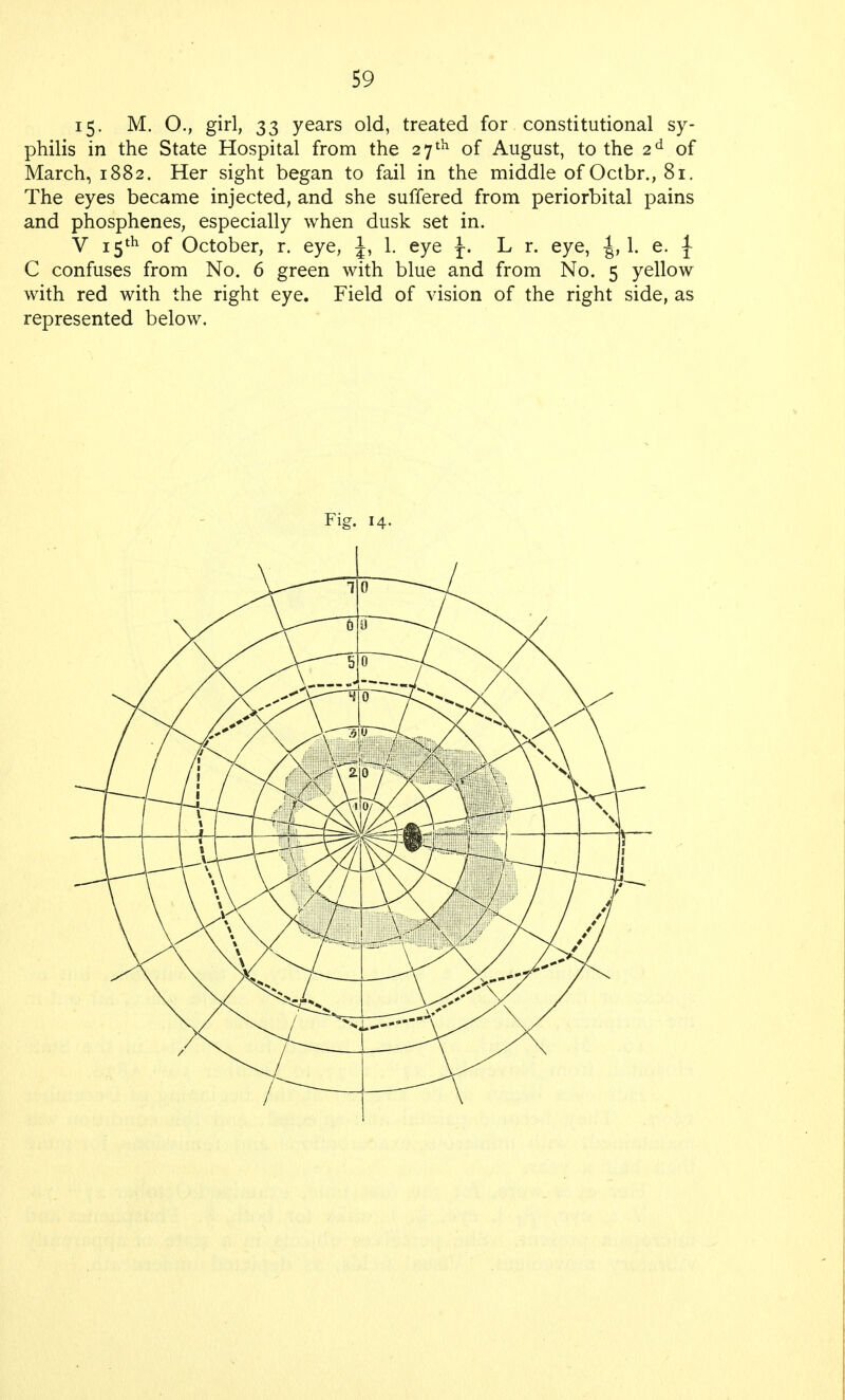 15. M. O., girl, 33 years old, treated for constitutional sy- philis in the State Hospital from the 27 th of August, to the 2d of March, 1882. Her sight began to fail in the middle of Octbr., 81. The eyes became injected, and she suffered from periorbital pains and phosphenes, especially when dusk set in. V 15th of October, r. eye, J, L. eye J. L r. eye, -J, 1. e. \ C confuses from No. 6 green with blue and from No. 5 yellow with red with the right eye. Field of vision of the right side, as represented below. Fig. 14.