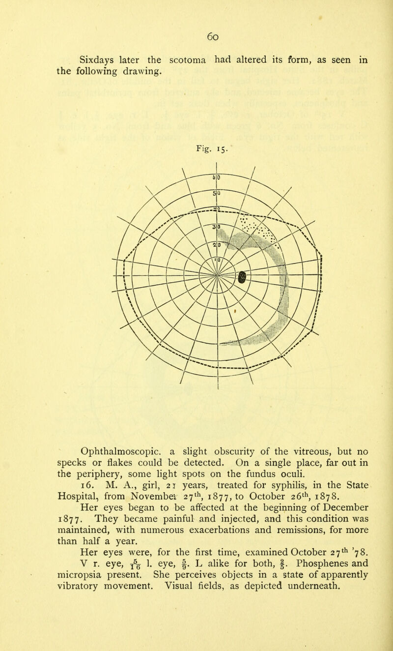 Sixdays later the scotoma had altered its form, as seen in the following drawing. Fig. 15- Ophthalmoscopic, a slight obscurity of the vitreous, but no specks or flakes could be detected. On a single place, far out in the periphery, some light spots on the fundus oculi. 16. M. A., girl, 21 years, treated for syphilis, in the State Hospital, from November 27th, 1877, to October 26th, 1878. Her eyes began to be affected at the beginning of December 1877. They became painful and injected, and this condition was maintained, with numerous exacerbations and remissions, for more than half a year. Her eyes were, for the first time, examined October 27th '78. V r. eye, t5q 1. eye, §. L alike for both, §. Phosphenes and micropsia present. She perceives objects in a state of apparently vibratory movement. Visual fields, as depicted underneath.