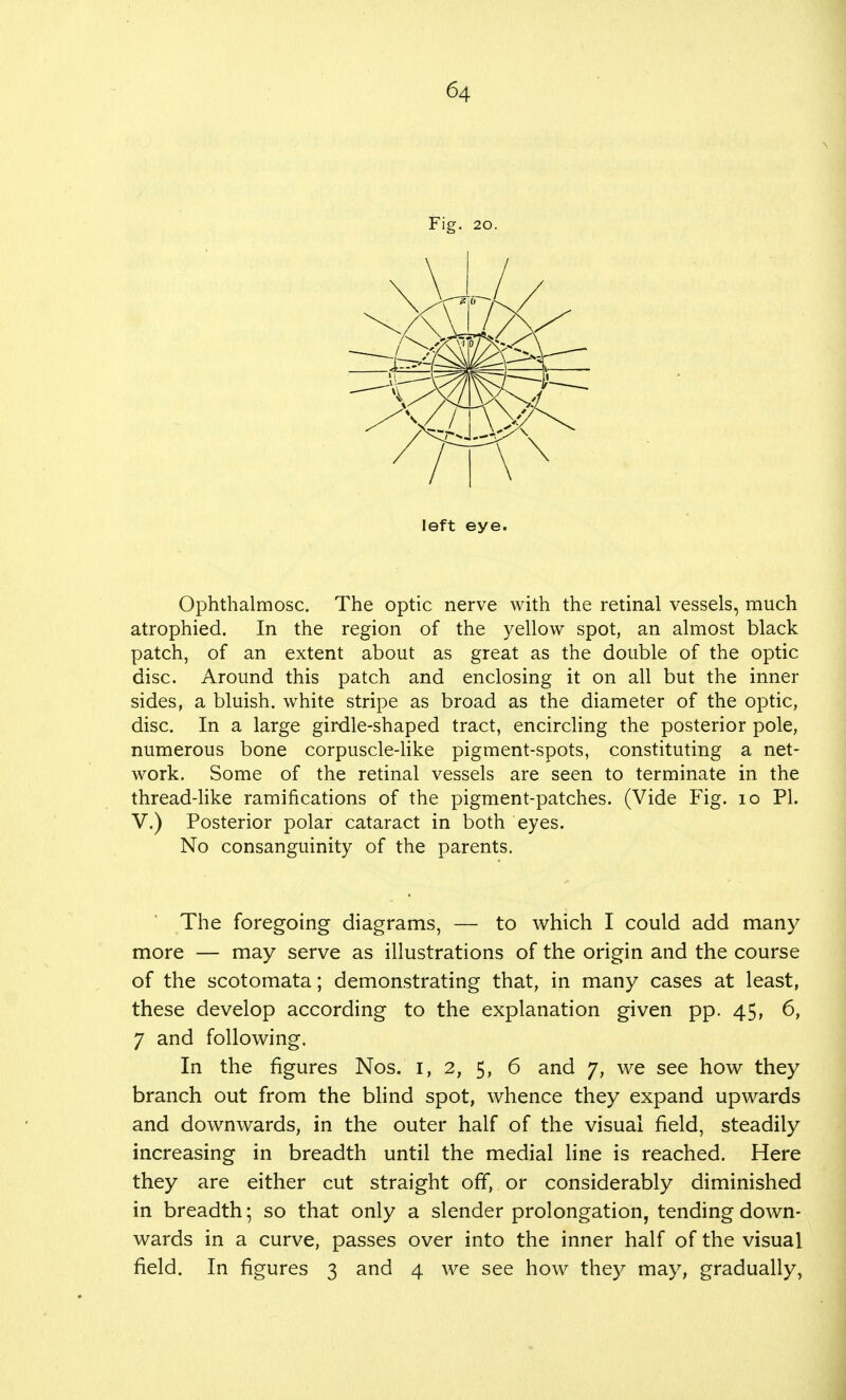 Fig. 20. left eye. Ophthalmosc. The optic nerve with the retinal vessels, much atrophied. In the region of the yellow spot, an almost black patch, of an extent about as great as the double of the optic disc. Around this patch and enclosing it on all but the inner sides, a bluish, white stripe as broad as the diameter of the optic, disc. In a large girdle-shaped tract, encircling the posterior pole, numerous bone corpuscle-like pigment-spots, constituting a net- work. Some of the retinal vessels are seen to terminate in the thread-like ramifications of the pigment-patches. (Vide Fig. 10 PL V.) Posterior polar cataract in both eyes. No consanguinity of the parents. The foregoing diagrams, — to which I could add many more — may serve as illustrations of the origin and the course of the scotomata; demonstrating that, in many cases at least, these develop according to the explanation given pp. 45, 6, 7 and following. In the figures Nos. 1, 2, 5, 6 and 7, we see how they branch out from the blind spot, whence they expand upwards and downwards, in the outer half of the visual field, steadily increasing in breadth until the medial line is reached. Here they are either cut straight off, or considerably diminished in breadth; so that only a slender prolongation, tending down- wards in a curve, passes over into the inner half of the visual field. In figures 3 and 4 we see how they may, gradually,