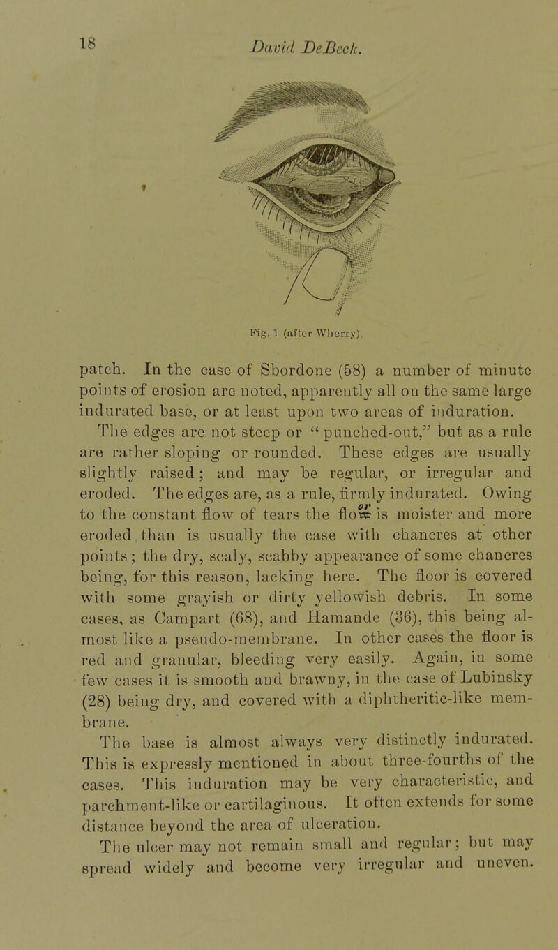 Fig. 1 (after Wherry) patch. In the case of Sborclone (58) a number of minute points of erosion are uoted, apparently all on the same large indurated base, or at least upon two areas of induration. The edges are not steep or  punched-out, but as a rule are rather sloping or rounded. These edges are usually slightly raised; and may be regular, or irregular and eroded. The edges are, as a rule, firmly indurated. Owing to the constant flow of tears the flow is moister and more eroded than is usually the case with chancres at other points; the dry, scaly, scabby appearance of some chancres being, for this reason, lacking here. The floor is covered with some grayish or dirty yellowish debris. In some cases, as Campart (68), and Hamande (36), this being al- most like a pseudo-membrane. In other cases the floor is red and granular, bleeding very easily. Again, in some few cases it is smooth and brawny, in the case of Lubinsky (28) being dry, and covered with a diphtheritic-like mem- brane. The base is almost always very distinctly indurated. This is expressly mentioned in about three-fourths of the cases. This induration may be very characteristic, and parchment-like or cartilaginous. It often extends for some distance beyond the area of ulceration. The ulcer may not remain small and regular; but may spread widely and become very irregular and uneven.