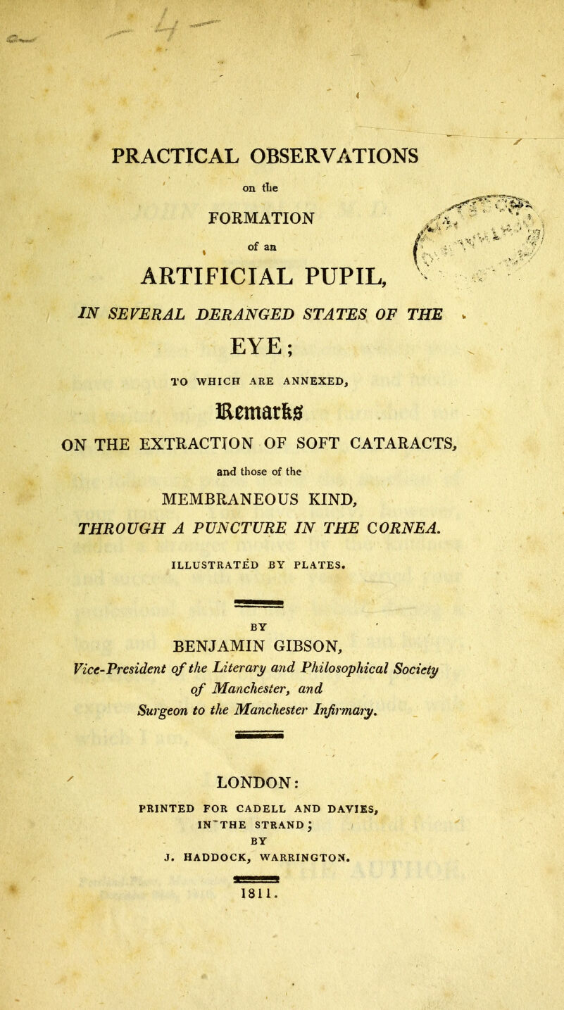 PRACTICAL OBSERVATIONS on tlie FORMATION » of an f' j ARTIFICIAL PUPIL, - IN SEVERAL DERANGED STATES OF THE EYE; TO WHICH ARE ANNEXED, Eematfes ON THE EXTRACTION OF SOFT CATARACTS, and those of the MEMBRANEOUS KIND, THROUGH A PUNCTURE IN THE CORNEA. ILLUSTRATED BY PLATES. BY BENJAMIN GIBSON, Vice-President of the Literary and Philosophical Society of Manchester, and Surgeon to the Manchester Injirmaiy. LONDON: PRINTED FOR CADELL AND DAVIES, IN'THE STRAND BY J. HADDOCK, WARRINGTON. 1811.