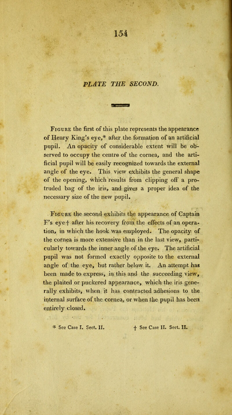 154 PLATE THE SECOND. Figure the first of this plate represents the appearance of Henry King's eye,* after the formation of an artificial pupil. An opacity of considerable extent will be ob- served to occupy the centre of the cornea, and the arti- ficial pupil will be easily recognized towards the external angle of the eye. This view exhibits the general shape of the opening, which results from clipping ofif a pro- truded bag of the iris, and gives a proper idea of the necessary size of the new pupil, FiGtrRE the second exhibits the appearance of Captain F's eyef after his recovery from the effects of an opera- tion, in which the hook was employed. The opacity of the cornea is more extensive than in the last view, parti- cularly towards the inner angle of the eye. The artificial pupil was not formed exactly opposite to the external angle of the eye, but rather below it. An attempt has been made to express, in this and the succeeding view, the plaited or puckered appearance, which the iris gene- rally exhibits, when it has contracted adhesions to the internal surface of the cornea, or when the pupil has been entirely closed. * See Case T. Sect, II. f See Case II. Sect. II.