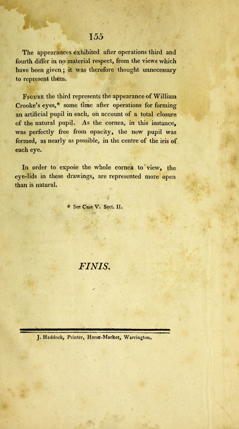 The appearances e^fhibited after operations third and fourth differ in no material respect, from the views which have been given; it was therefore thought unnecessary to represent them. Figure the third represents the appearance of William Crooke's eyes,* some time after operations for forming an artificial pupil in each, on account of a total closure of the natural pupil. As the cornea, in this instance, was perfectly free from opacity, the new pupil was formed, as nearly as possible, in the centre of the iris of each eye. In order to expose the whole cornea to view, the eye-lids in these drawings, are represented more open than is natural. * See Case V. Sect. II. FINIS. J. Haddock, Printer, Horse-Market, Warrington,