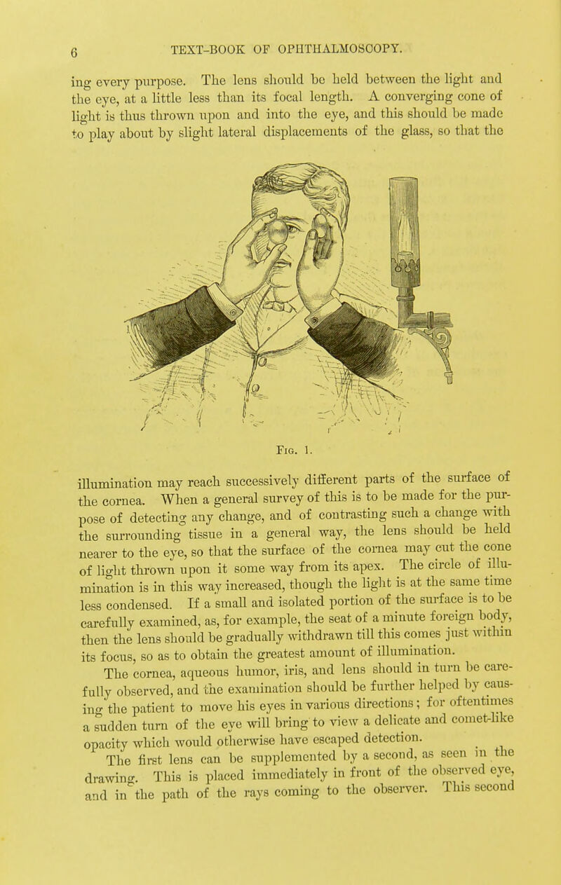 ing every purpose. The lens should be held between the light and the eye, at a little less than its focal length. A converging cone of light is thus thrown upon and into the eye, and this should be made to play about by slight lateral displacements of the glass, so that the Fig. 1. illumination may reach successively different parts of the surface of the cornea. When a general survey of this is to be made for the pur- pose of detecting any change, and of contrasting such a change with the surrounding tissue in a general way, the lens should be held nearer to the eye, so that the surface of the cornea may cut the cone of light thrown upon it some way from its apex. The circle of illu- mination is in this way increased, though the light is at the same time less condensed. If a small and isolated portion of the surface is to be carefully examined, as, for example, the seat of a minute foreign body, then the lens should be gradually withdrawn till this comes just within its focus, so as to obtain the greatest amount of illumination. The cornea, aqueous humor, iris, and lens should in turn be care- fully observed, and the examination should be further helped by caus- ing the patient to move his eyes in various directions; for oftentimes a sudden turn of the eye will bring to view a delicate and comet-like opacity which would otherwise have escaped detection. The first lens can be supplemented by a second, as seen m the drawing. This is placed immediately in front of the observed eye and in the path of the rays coming to the observer. This second