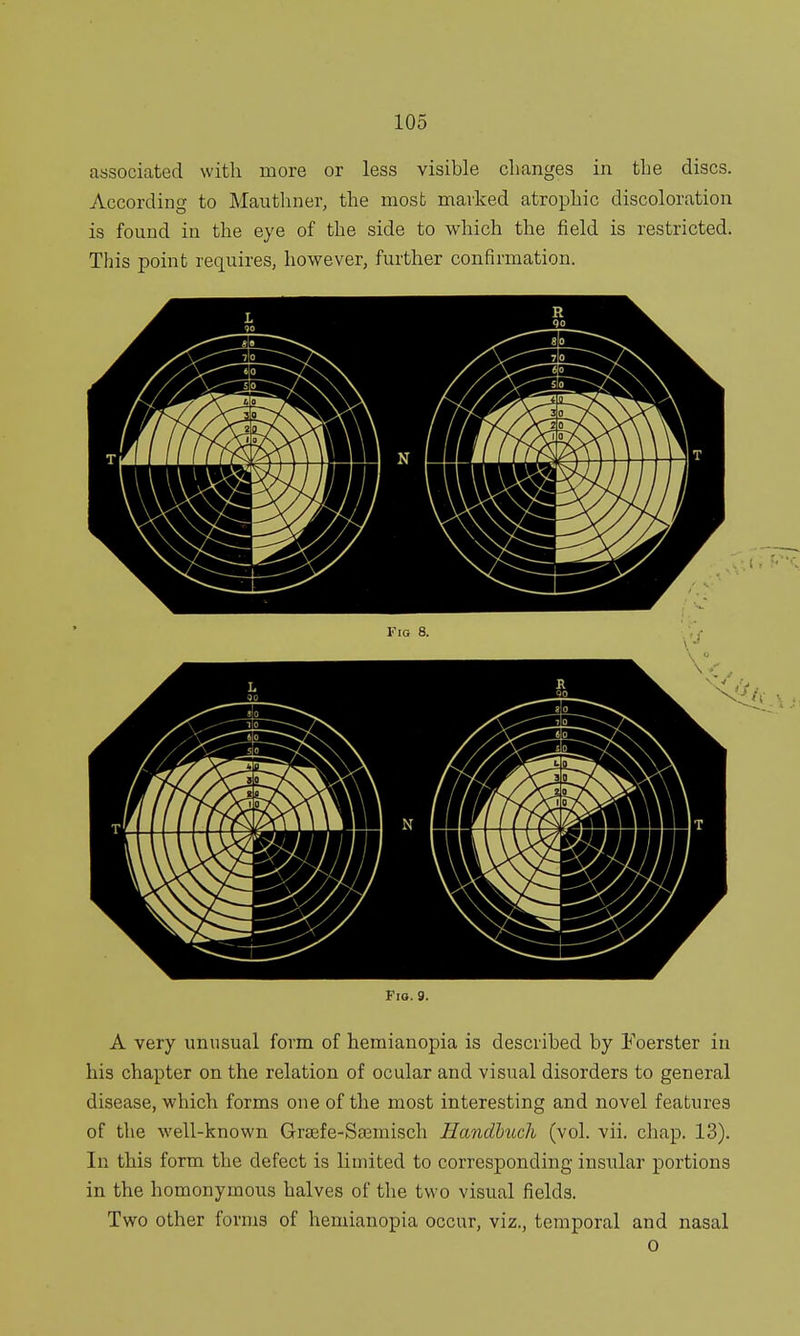 associated with more or less visible changes in the discs. According to Mauthner, the most marked atrophic discoloration is found in the eye of the side to which the field is restricted. This point requires, however, further confirmation. Fig. 9. A very unusual form of hemianopia is described by Foerster in his chapter on the relation of ocular and visual disorders to general disease, which forms one of the most interesting and novel features of the well-known Graife-Saamisch Handhuch (vol. vii. chap. 13). In this form the defect is limited to corresponding insular portions in the homonymous halves of the two visual fields. Two other forms of hemianopia occur, viz., temporal and nasal o