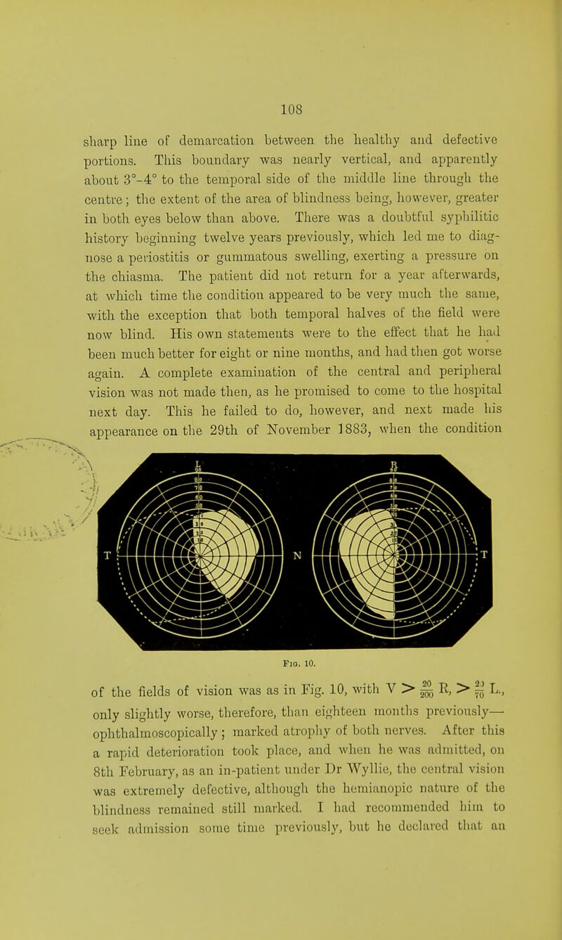 sharp line of demarcation between the healthy and defective portions. This boundary was nearly vertical, and apparently about 3°-4° to the temporal side of the middle line through the centre; the extent of the area of blindness being, however, greater in both eyes below than above. There was a doubtful syphilitic history beginning twelve years previously, which led me to diag- nose a periostitis or gummatous swelling, exerting a pressure on the chiasma. The patient did not return for a year afterwards, at which time the condition appeared to be very much the same, with the exception that both temporal halves of the field were now blind. His own statements were to the effect that he had been much better for eight or nine months, and had then got worse again. A complete examination of the central and peripheral vision was not made then, as he promised to come to the hospital next day. This he failed to do, however, and next made his appearance on the 29th of November 1883, when the condition Fio. 10. of the fields of vision was as in Fig. 10, with V > m R, > ~ L., only slightly worse, therefore, than eighteen months previously— ophthalmoscopically ; marked atrophy of both nerves. After this a rapid deterioration took place, and when he was admitted, on 8th February, as an in-patient under Dr Wyllie, the central vision was extremely defective, although the hemianopic nature of the blindness remained still marked. I had recommended him to geek admission some time previously, but he declared that an