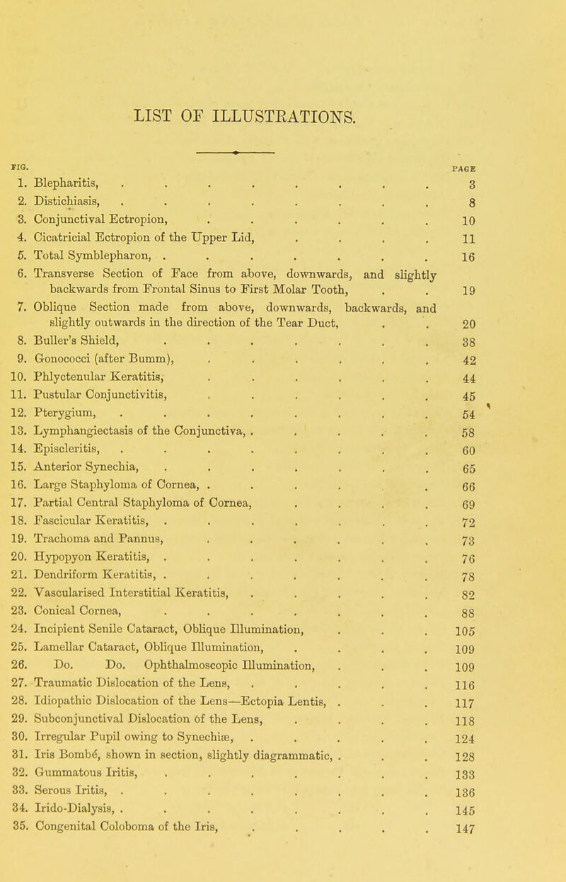 FIG. 1. 2. 3. 4. 5. 6. 7. 9. 10. 11. 12. 13. 14. 15. 16. 17. 18. 19. 20. 21. 22. 23. 24. 25. 26. 27. 28. 29. 30. 31. 32. 33. 34. 35. PAGE Blepharitis, ........ 3 Distichiasis, ........ g Conjunctival Ectropion, ...... 10 Cicatricial Ectropion of the Upper Lid, .... 11 Total Sjntnblepharon, . . . . . . .16 Transverse Section of Face from above, downwards, and slightly backwards from Erontal Sinus to First Molar Tooth, . . 19 Oblique Section made from above, downwards, backwards, and slightly outwards in the direction of the Tear Duct, . . 20 BuUer's Shield, . . . . , , .38 Gonococci (after Bumm), ...... 42 Phlyctenular Keratitis, ...... 44 Pustular Conjunctivitis, 46 Pterygium, ........ 54 Lymphangiectasis of the Conjunctiva, . . . . . 68 Episcleritis, ........ 60 Anterior Synechia, ....... 65 Large Staphyloma of Cornea, ...... 66 Partial Central Staphyloma of Cornea, .... 69 Fascicular Keratitis, ....... 72 Trachoma and Pannus, 73 Hypopyon Keratitis, 76 Dendriform Keratitis, . . . , , . .78 Vascularised Interstitial Keratitis, , . . . .82 Conical Cornea, ....... 88 Incipient Senile Cataract, Oblique Illumination, . . . 105 Lamellar Cataract, Oblique Illumination, . . . .109 Do. Do. Ophthalmoscopic Illumination, . . .109 Traumatic Dislocation of the Lens, . , . . .116 Idiopathic Dislocation of the Lens—Ectopia Lentis, . . .117 Subconjimctival Dislocation of the Lens, . . . .118 Irregiilar Pupil owing to Synechise, ..... 124 Iris Bomb^, shown in section, slightly diagrammatic, . , .128 Gummatous Iritis, . . , . . . .133 Serous Iritis, . . . . . . , .136 Irido-Dialysis, ........ 145 Congenital Coloboma of the Iris, . . . . .147