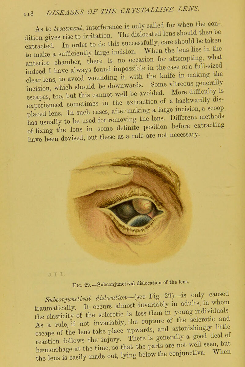 As to Mment, interfereaoe is only called for when the con- dition gives rise to irritation. The dislocated lens should then be eZcted In order to do this suecessfully, care should be taken 0 Zke a sufficiently large incision. When the lens hes :n the anterior chamber, there is no ^f» what indeed I have always found impossible in the case of a f ull-sized clear lens, to avoid wounding it with the knife in making the indsion which should be downwards. Some vitreous generally es ° too, but this cannot well be avoided More d« is experienced sometimes in the extraction of a backwardly dis- Zed lens. In such cases, after making a large incision, a scoop hirusuaUy to be used for removing the lens. Different methods of fixL' the lens in some definite position before extracting have be°en devised, but these as a rule are not necessary. J.T.T Fig. 29.—Subconjunctival dislocatiou of the leus. SuiconjmM didooation-i^^ Rg. 29 -is only caused tranmatically. It occurs almost invai-iably m adults, m whom Sa Sty of the sclerotic is less than in young individuals. As if not invariably, the rupture of the .sclerotic and fscape of the lens tal.e place upwards, and astomslimgly li tie aSn foUows the injury. There is generaUy a good deal o h«ha«e at the time, so that the parts are not weU seen^bnt thTl ns ^easUy made out, lying below the conjunctiva. When