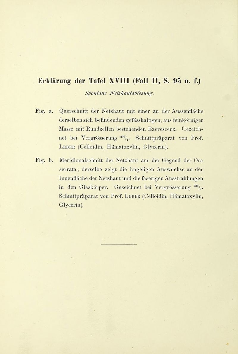 spontane Netzhautablöstmg. Fig. a. Quersclmitt der Netzliaut mit einer an der Aiissenfläclie derselben sieil befindenden gefässlialtigen, aus feinkörniger Masse mit Eundzellen bestellenden Excrescenz. Gezeicli- net bei Vergrössermig ^'^^'/i- Sclmittpräparat von Prof. Leber (Celloidin, Hämatoxylin, Glycerin). Fig. b. Meridionalsclmitt der Netzhaut aus der Gegend der Ora serrata; derselbe zeigt die liügeligen Auswüclise an der Innenfläclie der Netzliaut und die faserigen Ausstrablungen in den Glaskörper. Gezeiclniet bei Vergrösserung Sclmittpräparat von Prof. Leber (Celloidin, Hämatoxylin, Glycerin).