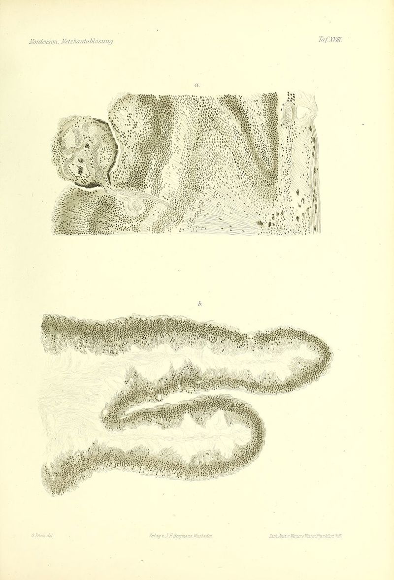 Nordeiisoii, Netzhaivtahlösiiiig. ' ..-i/--- • ....... r.^;ws<.{-Ä:% • » r ■ ■..■t'.j.'ri»»!:»f_»,».v*,v»,,,- OntersM. V:irlag v.J.r. Berjnian.ii.\ Wiesoadm. Litk-AmU'Jf!rizirjf&ter.Fntnkf:L'-t''/M.