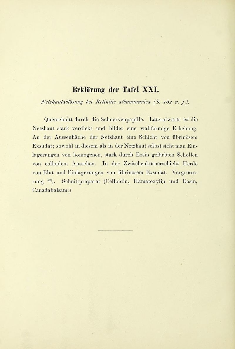 Netzhaiitabl'östmg bei Retinitis albinnimtrica (S. 162 n. f.). Querschnitt durcli die Selinervenpapille. Lateralwärts ist die Netzliaut stark verdickt und bildet eine wallförmige Erhebung. An der Aussenfläche der Netzhaut eine Schicht von fibrinösem Exsudat; sowohl in diesem als in der Netzhaut selbst sieht man Ein- lagerungen von homogenen, stark durch Eosin gefärbten Schollen von colloidem Aussehen. In der Zwischenkörnerschicht Herde von Blut und Einlagerungen von fibrinösem Exsudat. Vergrösse- rung ^^/j. Schnittpräparat (Celloidin, Hämatoxylin und Eosin, Canadabalsam.)