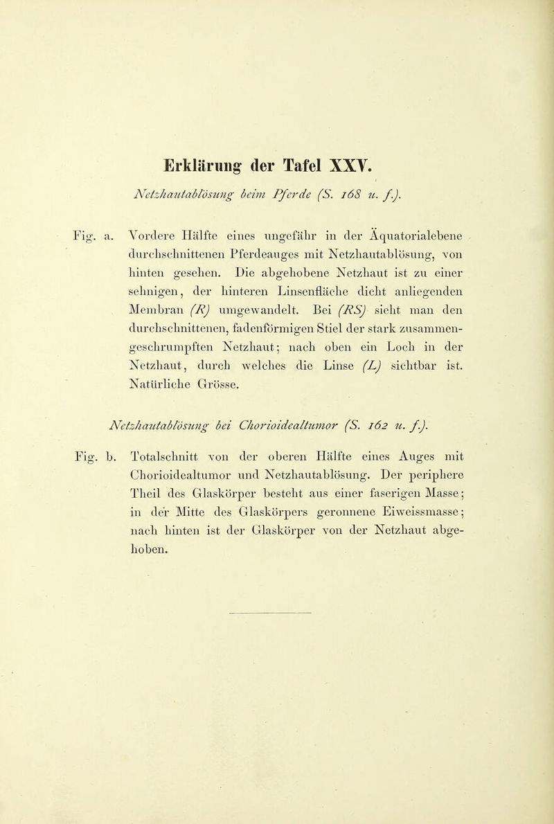 Netzhautablösung beim Pfei^de (S. i68 n. f.). Fig. a. Vordere Plälfte eines ungefälir in der Aquatorialebene durclisclmittenen Pferdeauges mit Netzliautablösung, von hinten gesellen. Die abgehobene Netzhaut ist zu einer sehnigen, der hinteren Linsenfläche dicht anliegenden Membran (R) umgewandelt. Bei (RS) sieht man den durchschnittenen, fadenförmigen Stiel der stark zusammen- geschrumpften Netzhaut; nach oben ein Loch in der Netzhaut, durch welches die Linse (L) sichtbar ist. Natürliche Grösse. Netzhaittabiösung bei Chorioidealttmior (S. 162 u. f.). Fig. b. Totalschnitt von der oberen Hälfte eines Auges mit Chorioidealtumor und Netzhautablösung. Der periphere Theil des Glaskörper besteht aus einer faserigen Masse; in der Mtte des Glaskörpers geronnene Eiweissmasse; nach hinten ist der Glaskörper Yon der Netzhaut abge- hoben.