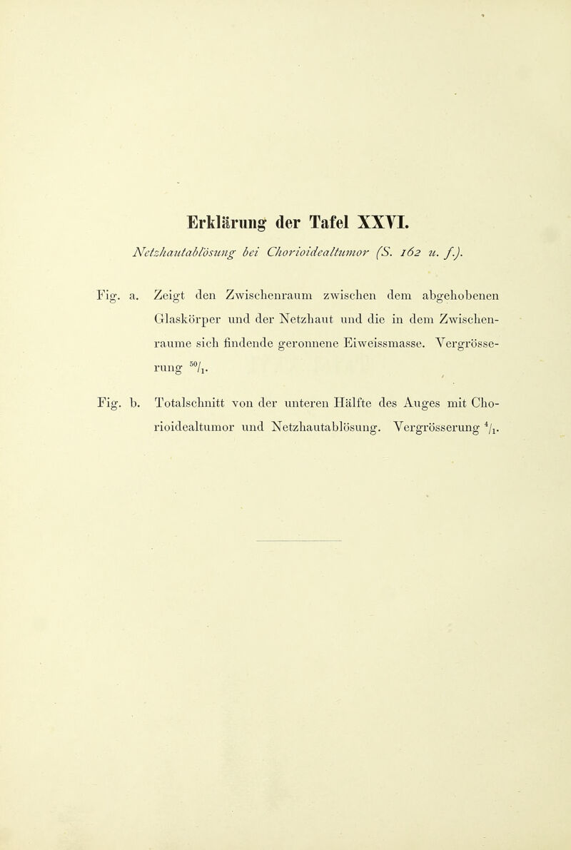 Netzhatitabl'ösimg bei CJiorioidealtwnor fS. 162 71. f.). Fig. a. Zeigt den Zwischenraum zwischen dem abgehobenen Glaskörper und der Netzhaut und die in dem Zwischen- räume sich findende geronnene Eiweissmasse. Yergrösse- rung Fig. b. Totalschnitt von der unteren Hälfte des Auges mit Cho- rioidealtumor und Netzhautablösung. Vergrösserung