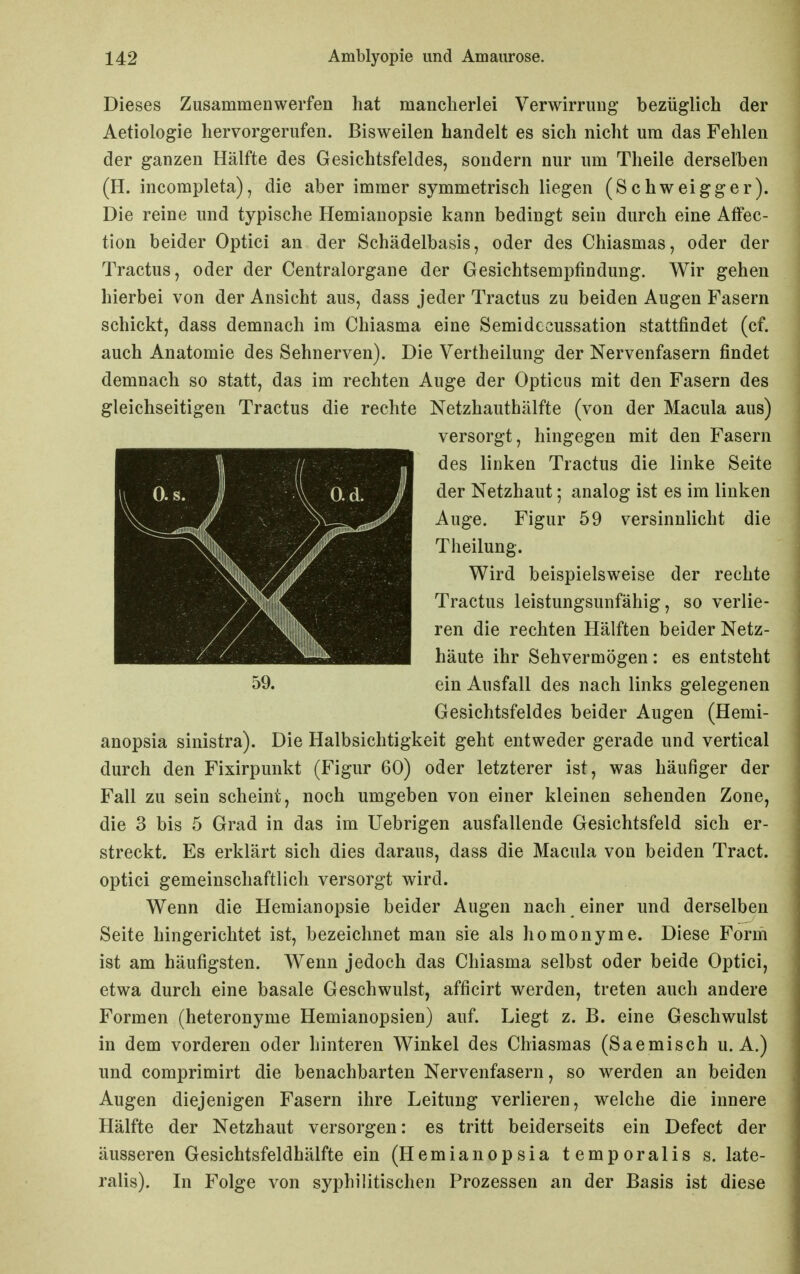 Dieses Zusammenwerfen hat mancherlei Verwirrung bezüglich der Aetiologie hervorgerufen. Bisweilen handelt es sich nicht um das Fehlen der ganzen Hälfte des Gesichtsfeldes, sondern nur um Theile derselben (H. incompleta), die aber immer symmetrisch liegen (Schweigger). Die reine und typische Hemianopsie kann bedingt sein durch eine Affec- tion beider Optici an der Schädelbasis, oder des Chiasmas, oder der Tractus, oder der Centraiorgane der Gesichtsempfindung. Wir gehen hierbei von der Ansicht aus, dass jeder Tractus zu beiden Augen Fasern schickt, dass demnach im Chiasma eine Semidecussation stattfindet (cf. auch Anatomie des Sehnerven). Die Vertheilung der Nervenfasern findet demnach so statt, das im rechten Auge der Opticus mit den Fasern des gleichseitigen Tractus die rechte Netzhauthälfte (von der Macula aus) versorgt, hingegen mit den Fasern des linken Tractus die linke Seite der Netzhaut; analog ist es im linken Auge. Figur 59 versinnlicht die Theilung. Wird beispielsweise der rechte Tractus leistungsunfähig, so verlie- ren die rechten Hälften beider Netz- häute ihr Sehvermögen: es entsteht 59. ein Ausfall des nach links gelegenen Gesichtsfeldes beider Augen (Hemi- anopsia sinistra). Die Halbsichtigkeit geht entweder gerade und vertical durch den Fixirpunkt (Figur 60) oder letzterer ist, was häufiger der Fall zu sein scheint, noch umgeben von einer kleinen sehenden Zone, die 3 bis 5 Grad in das im Uebrigen ausfallende Gesichtsfeld sich er- streckt. Es erklärt sich dies daraus, dass die Macula von beiden Tract. optici gemeinschaftlich versorgt wird. Wenn die Hemianopsie beider Augen nach einer und derselben Seite hingerichtet ist, bezeichnet man sie als homonyme. Diese Form ist am häufigsten. Wenn jedoch das Chiasma selbst oder beide Optici, etwa durch eine basale Geschwulst, afficirt werden, treten auch andere Formen (heteronyme Hemianopsien) auf. Liegt z. B. eine Geschwulst in dem vorderen oder hinteren Winkel des Chiasmas (Saemisch u. A.) und comprimirt die benachbarten Nervenfasern, so werden an beiden Augen diejenigen Fasern ihre Leitung verlieren, welche die innere Hälfte der Netzhaut versorgen: es tritt beiderseits ein Defect der äusseren Gesichtsfeldhälfte ein (Hemianopsia temporalis s. late- ralis). In Folge von syphilitischen Prozessen an der Basis ist diese