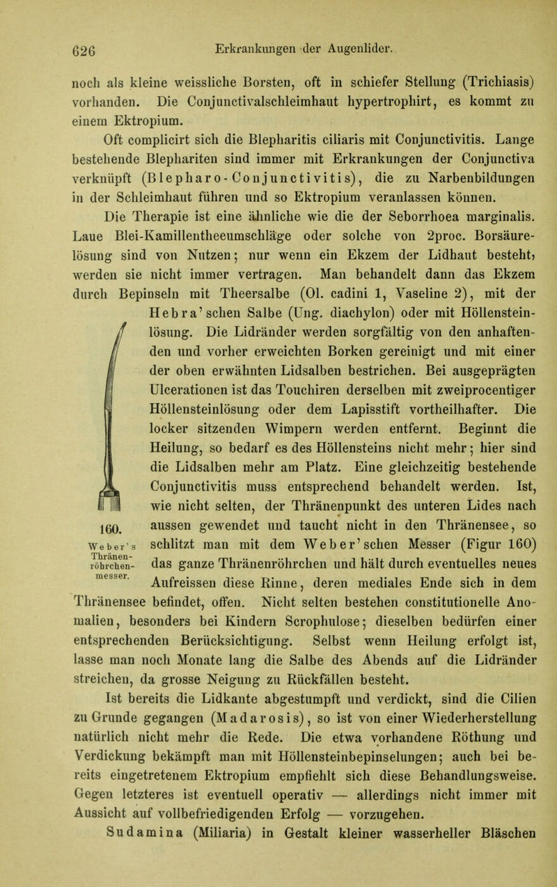 noch als kleine weissliche Borsten, oft in schiefer Stellung (Trichiasis) vorhanden. Die Conjunctivalschleimhaut hypertrophirt, es kommt zu einem Ektropium. Oft complicirt sich die Blepharitis ciliaris mit Conjunctivitis. Lange bestehende Blephariten sind immer mit Erkrankungen der Conjunctiva verknüpft (Blepharo-Conjunctivitis), die zu Narbenbildungen in der Schleimhaut führen und so Ektropium veranlassen können. Die Therapie ist eine ähnliche wie die der Seborrhoea marginalis. Laue Blei-Kamillentheeumschläge oder solche von 2proc. Borsäure- lösung sind von Nutzen; nur wenn ein Ekzem der Lidhaut besteht? werden sie nicht immer vertragen. Man behandelt dann das Ekzem durch Bepinseln mit Theersalbe (Ol. cadini 1, Vaseline 2), mit der Hebra'sehen Salbe (Ung. diachylon) oder mit Höllenstein- lösung. Die Lidränder werden sorgfältig von den anhaften- den und vorher erweichten Borken gereinigt und mit einer der oben erwähnten Lidsalben bestrichen. Bei ausgeprägten Ulcerationen ist das Touchiren derselben mit zweiprocentiger Höllensteinlösung oder dem Lapisstift vortheilhafter. Die locker sitzenden Wimpern werden entfernt. Beginnt die Heilung, so bedarf es des Höllensteins nicht mehr; hier sind die Lidsalben mehr am Platz. Eine gleichzeitig bestehende Conjunctivitis muss entsprechend behandelt werden. Ist, irii wie nicht selten, der Thränenpunkt des unteren Lides nach aussen gewendet und taucht nicht in den Thränensee, so Weber s schützt man mit dem Web er'sehen Messer (Figur 160) röhrchen- das ganze Thränenröhrchen und hält durch eventuelles neues messer. Aufrcisscn dicsc Rinne, deren mediales Ende sich in dem Thränensee befindet, offen. Nicht selten bestehen constitutionelle Ano- malien, besonders bei Kindern Scrophulose; dieselben bedürfen einer entsprechenden Berücksichtigung. Selbst wenn Heilung erfolgt ist, lasse man noch Monate lang die Salbe des Abends auf die Lidränder streichen, da grosse Neigung zu Rückfällen besteht. Ist bereits die Lidkante abgestumpft und verdickt, sind die Cilien zu Grunde gegangen (Madarosis), so ist von einer Wiederherstellung natürlich nicht mehr die Rede. Die etwa vorhandene Röthung und Verdickung bekämpft man mit Höllensteinbepinselungen; auch bei be- reits eingetretenem Ektropium empfiehlt sich diese Behandlungsweise. Gegen letzteres ist eventuell operativ — allerdings nicht immer mit Aussicht auf vollbefriedigenden Erfolg — vorzugehen. Sudamina (Miliaria) in Gestalt kleiner wasserheller Bläschen