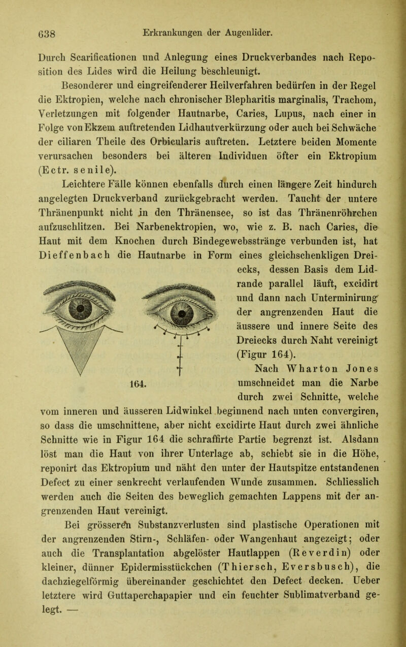 Durch Scarificationen und Anlegung eines Druckverbandes nach Repo- sition des Lides wird die Heilung beschleunigt. Besonderer und eingreifenderer Heilverfahren bedürfen in der Regel die Ektropien, welche nach chronischer Blepharitis marginalis, Trachom, Verletzungen mit folgender Hautnarbe, Caries, Lupus, nach einer in Folge von Ekzem auftretenden Lidhautverkürzung oder auch bei Schwäche der ciliaren Theile des Orbicularis auftreten. Letztere beiden Momente verursachen besonders bei älteren Individuen öfter ein Ektropium (Ectr. senile). Leichtere Fälle können ebenfalls durch einen längere Zeit hindurch angelegten Druckverband zurückgebracht werden. Taucht der untere Thränenpunkt nicht in den Thränensee, so ist das Thränenröhrchen aufzuschlitzen. Bei Narbenektropien, wo, wie z. B. nach Caries, die Haut mit dem Knochen durch Bindegewebsstränge verbunden ist, hat Dieffenbach die Hautnarbe in Form eines gleichschenkligen Drei- ecks, dessen Basis dem Lid- rande parallel läuft, excidirt und dann nach ünterminirung der angrenzenden Haut die äussere und innere Seite des Dreiecks durch Naht vereinigt (Figur 164). Nach Wharton Jones 164. umschneidet man die Narbe durch zwei Schnitte, welche vom inneren und äusseren Lidwinkel beginnend nach unten convergiren, so dass die umschnittene, aber nicht excidirte Haut durch zwei ähnliche Schnitte wie in Figur 164 die schraffirte Partie begrenzt ist. Alsdann löst man die Haut von ihrer Unterlage ab, schiebt sie in die Höhe, reponirt das Ektropium und näht den unter der Hautspitze entstandenen Defect zu einer senkrecht verlaufenden Wunde zusammen. Schliesslich werden auch die Seiten des beweglich gemachten Lappens mit der an- grenzenden Haut vereinigt. Bei grösser^ Substanzverlusten sind plastische Operationen mit der angrenzenden Stirn-, Schläfen- oder Wangenhaut angezeigt; oder auch die Transplantation abgelöster Hautlappen (Reverdin) oder kleiner, dünner Epidermisstückchen (Thiersch, Eversbusch), die dachziegelförmig übereinander geschichtet den Defect decken, lieber letztere wird Guttaperchapapier und ein feuchter Sublimatverband ge- legt. —