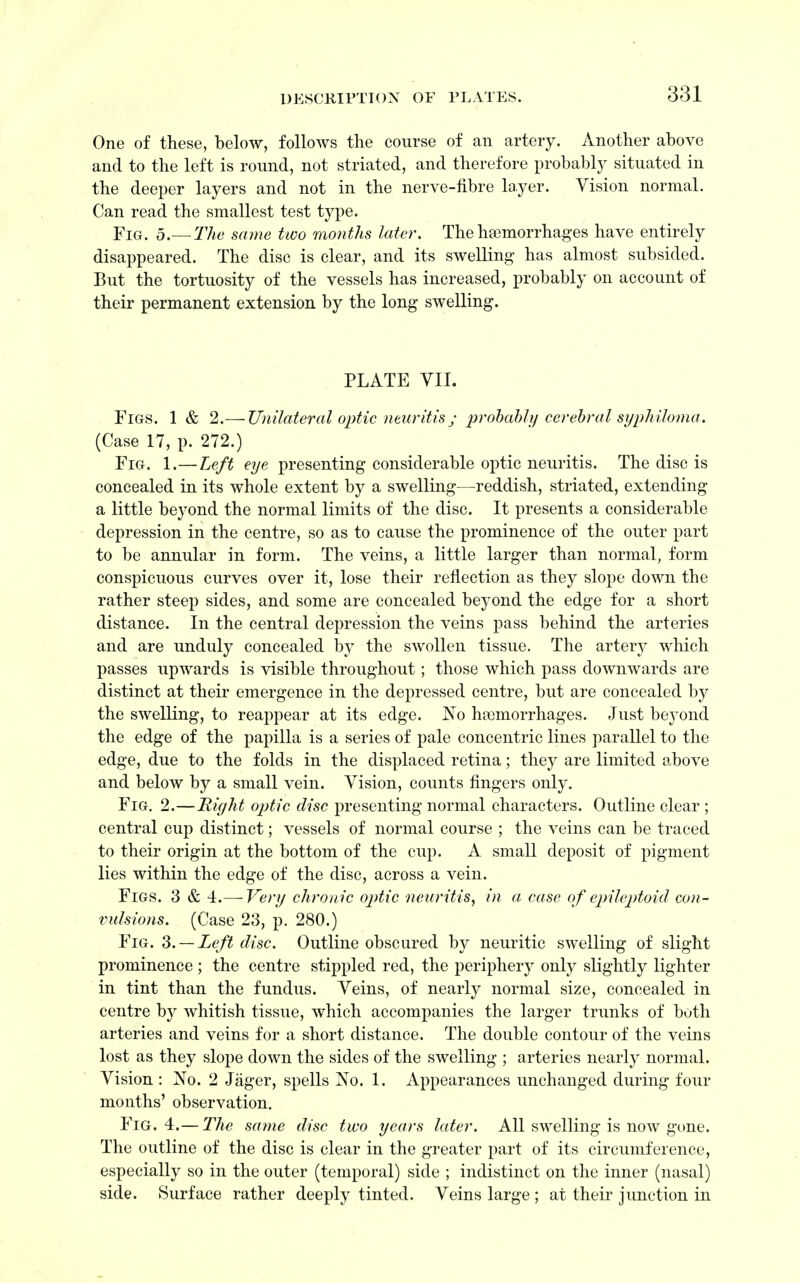 One of these, below, follows the course of can artery. Another above and to the left is round, not striated, and therefore probably situated in the deeper layers and not in the nerve-fibre layer. Vision normal. Can read the smallest test type. Fig. 5.— The same two months later. The hemorrhages have entirely disappeared. The disc is clear, and its swelling- has almost subsided. But the tortuosity of the vessels has increased, probably on account of their permanent extension by the long swelling. PLATE VII. Figs. 1 & 2.— Unilateral optic neuritis; probably cerebral syphiloma. (Case 17, p. 272.) Fig. 1.—Left eye presenting considerable optic neuritis. The disc is concealed in its whole extent by a swelling—reddish, striated, extending a little beyond the normal limits of the disc. It presents a considerable depression in the centre, so as to cause the prominence of the outer part to be annular in form. The veins, a little larger than normal, form conspicuous curves over it, lose their reflection as they slope down the rather steep sides, and some are concealed beyond the edge for a short distance. In the central depression the veins pass behind the arteries and are unduly concealed by the swollen tissue. The artery which passes upwards is visible throughout; those which pass downwards are distinct at their emergence in the depressed centre, but are concealed by the swelling, to reappear at its edge. No haemorrhages. Just beyond the edge of the papilla is a series of pale concentric lines parallel to the edge, due to the folds in the displaced retina; they are limited above and below by a small vein. Vision, counts fingers only. Fig. 2.—Right optic disc presenting normal characters. Outline clear ; central cup distinct; vessels of normal course ; the veins can be traced to their origin at the bottom of the cup. A small deposit of pigment lies within the edge of the disc, across a vein. Figs. 3 & 4.— Very chronic optic neuritis, in a case of epileptoid con- vulsions. (Case 23, p. 280.) Fig. 3. —Left disc. Outline obscured by neuritic swelling of slight prominence ; the centre stippled red, the periphery only slightly lighter in tint than the fundus. Veins, of nearly normal size, concealed in centre by whitish tissue, which accompanies the larger trunks of both arteries and veins for a short distance. The double contour of the veins lost as they slope down the sides of the swelling ; arteries nearly normal. Vision : No. 2 Jager, spells No. 1. Appearances unchanged during four months' observation. Fig. 4.— The same disc two years later. All swelling is now gone. The outline of the disc is clear in the greater part of its circumference, especially so in the outer (temporal) side ; indistinct on the inner (nasal) side. Surface rather deeply tinted. Veins large ; at their junction in